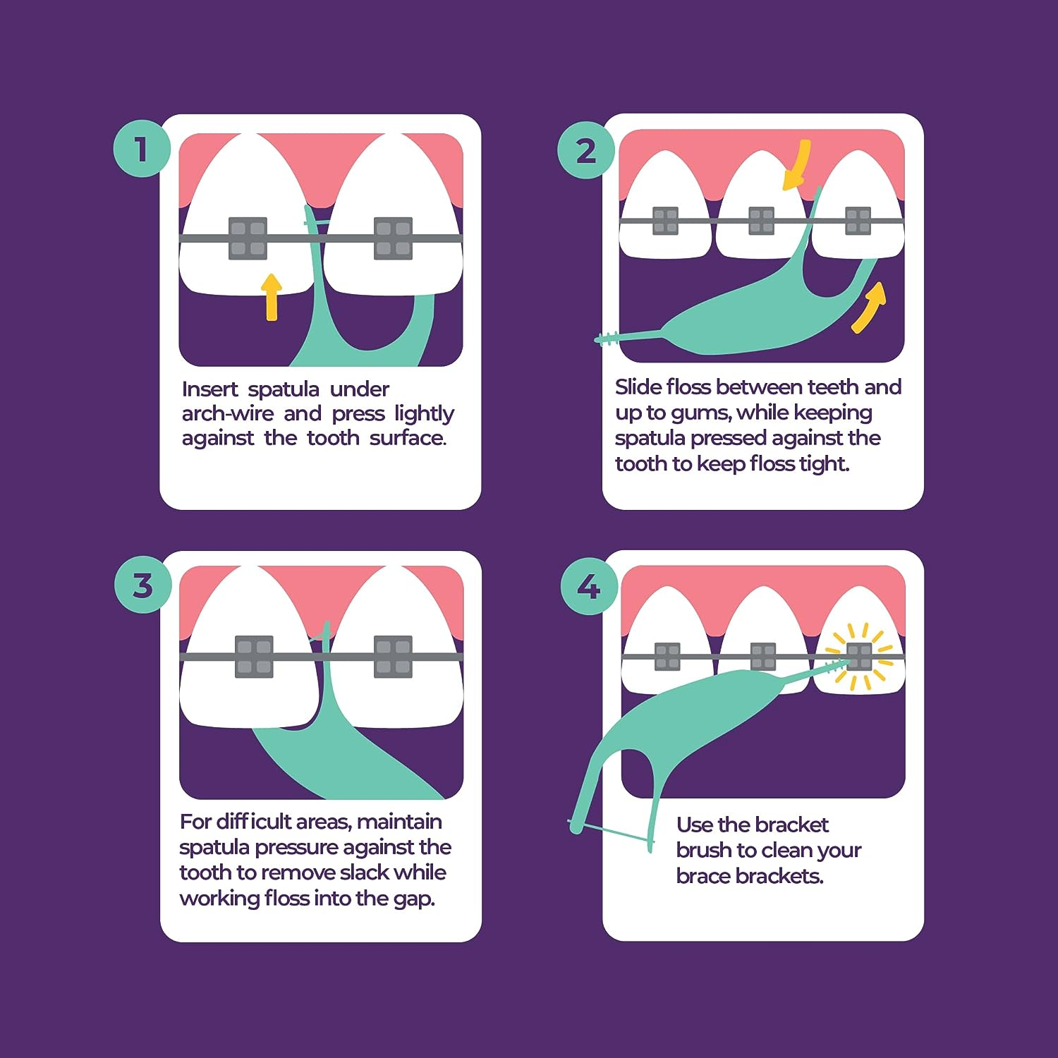 Platypus Orthodontic Flossers for Braces | Ortho Picks for Adults & Kids | Fits under Arch Wire | Non-Damaging | Encourage Flossing Habits | Floss Teeth in Less than Two Minutes | 40 Count (Pack of 1) image number 4