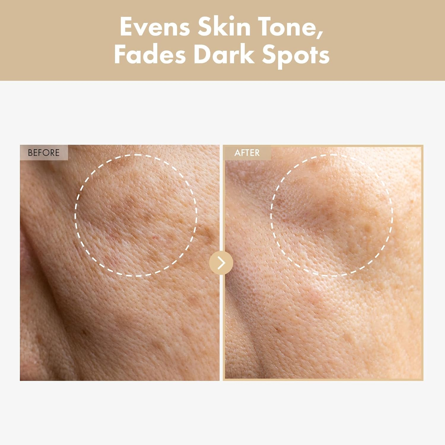 TOSOWOONG Rice Glow Milky Toner with 784,000Ppm Korean Rice Water, Niacinamide, Ceramides, Panthenol, Glow, Glass Skin, Hydrating, Purifying, Fragrance-Free, Korean Skin Care, 250Ml, 8.45 Fl.Oz. image number 1