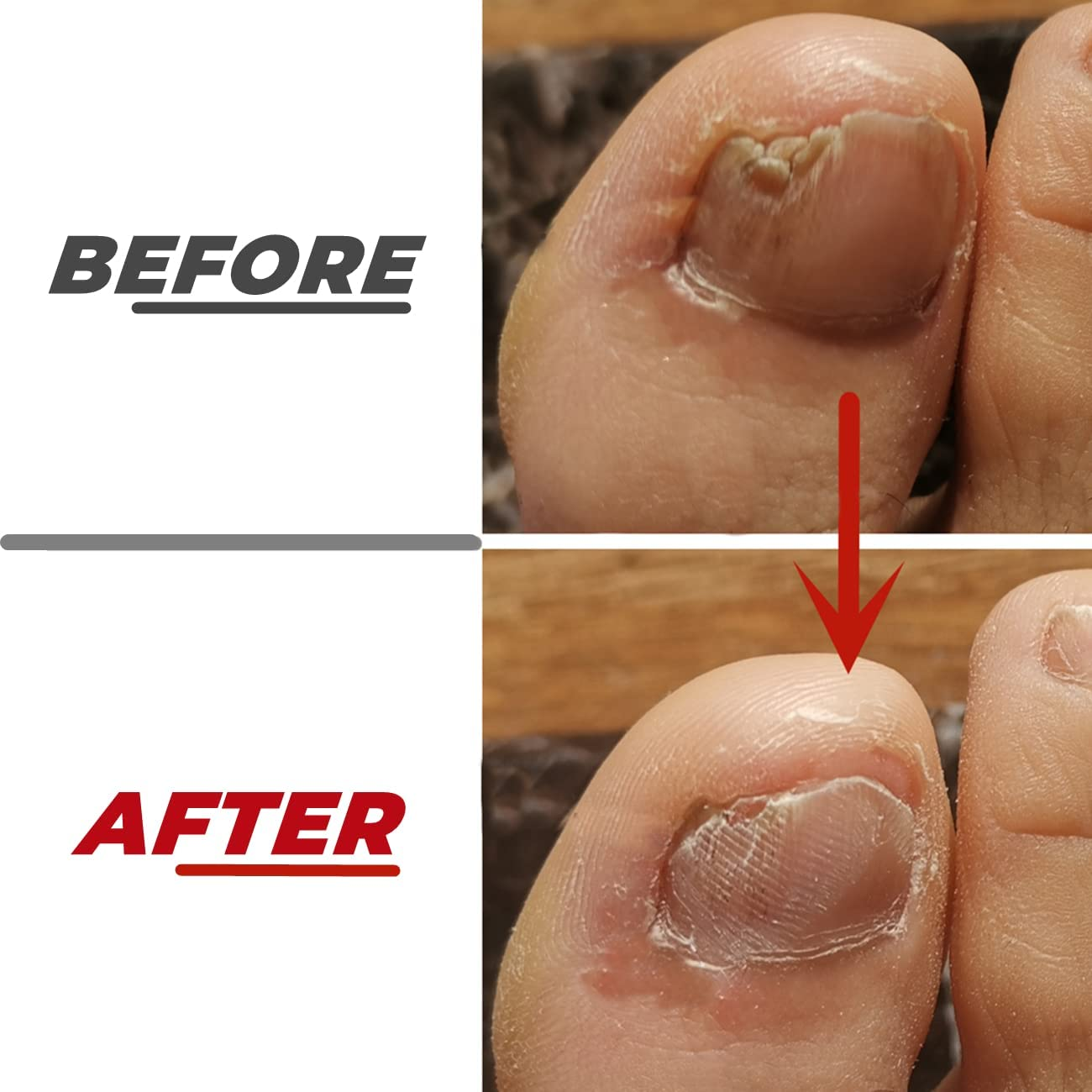 2 Pieces Toe Nail Files for Thick Nails,Stainless Steel, 4 Sides for Men Seniors & Dogs image number 1