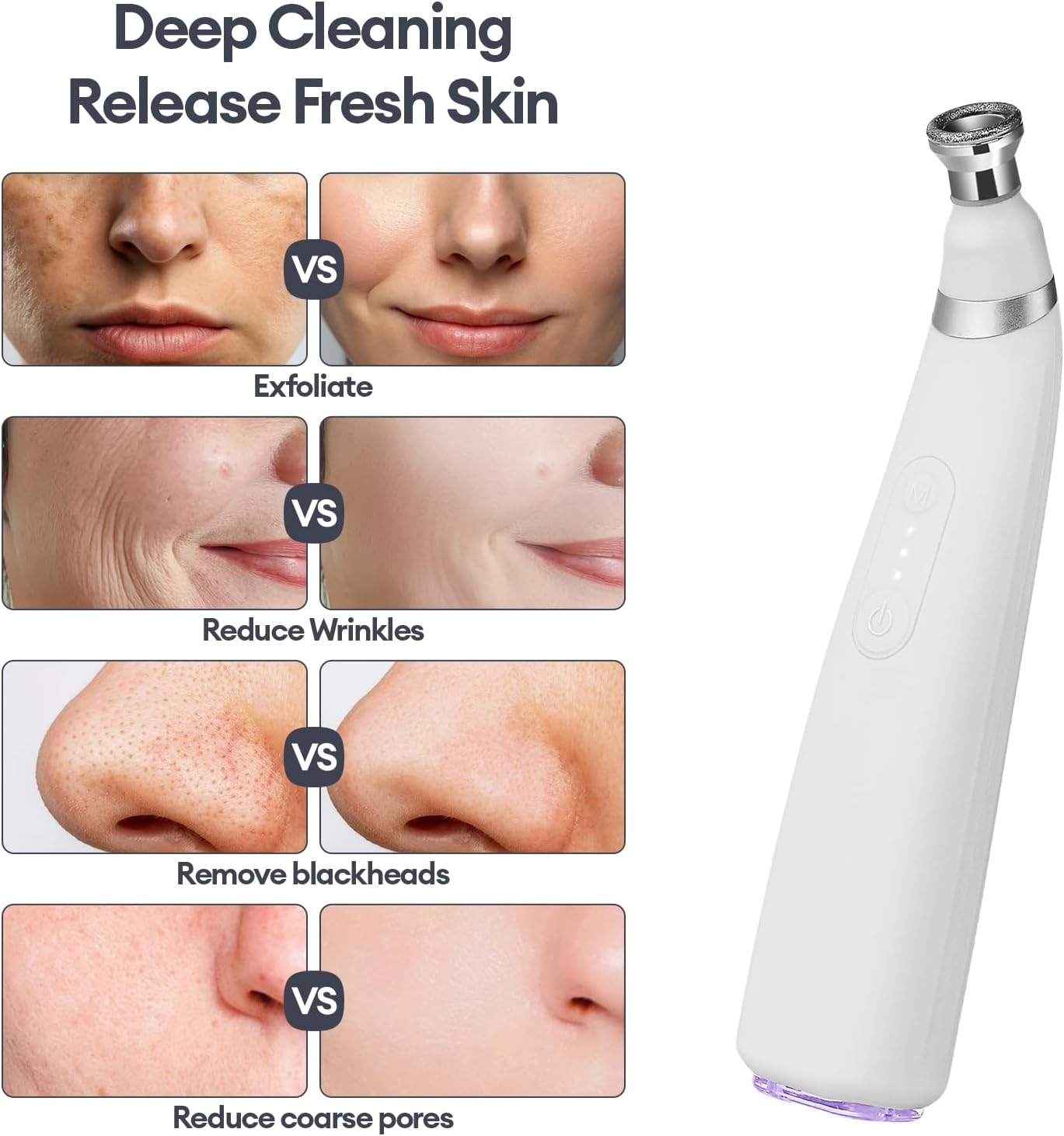 Iebilif Diamond Microdermabrasion Machine, 3 Modes Diamond Microdermabrasion Dermabrasion Machine for Blackhead Removal, Professional Portable Home Travel Microdermabrasion Device image number 2