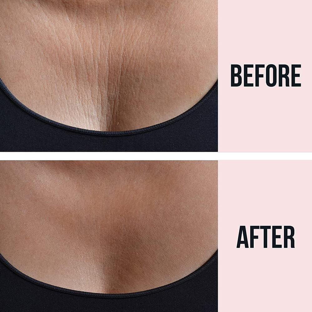 3X Women Chest Silicone Reusable Pads Ladies Female Transparent Anti-Wrinkle image number 2