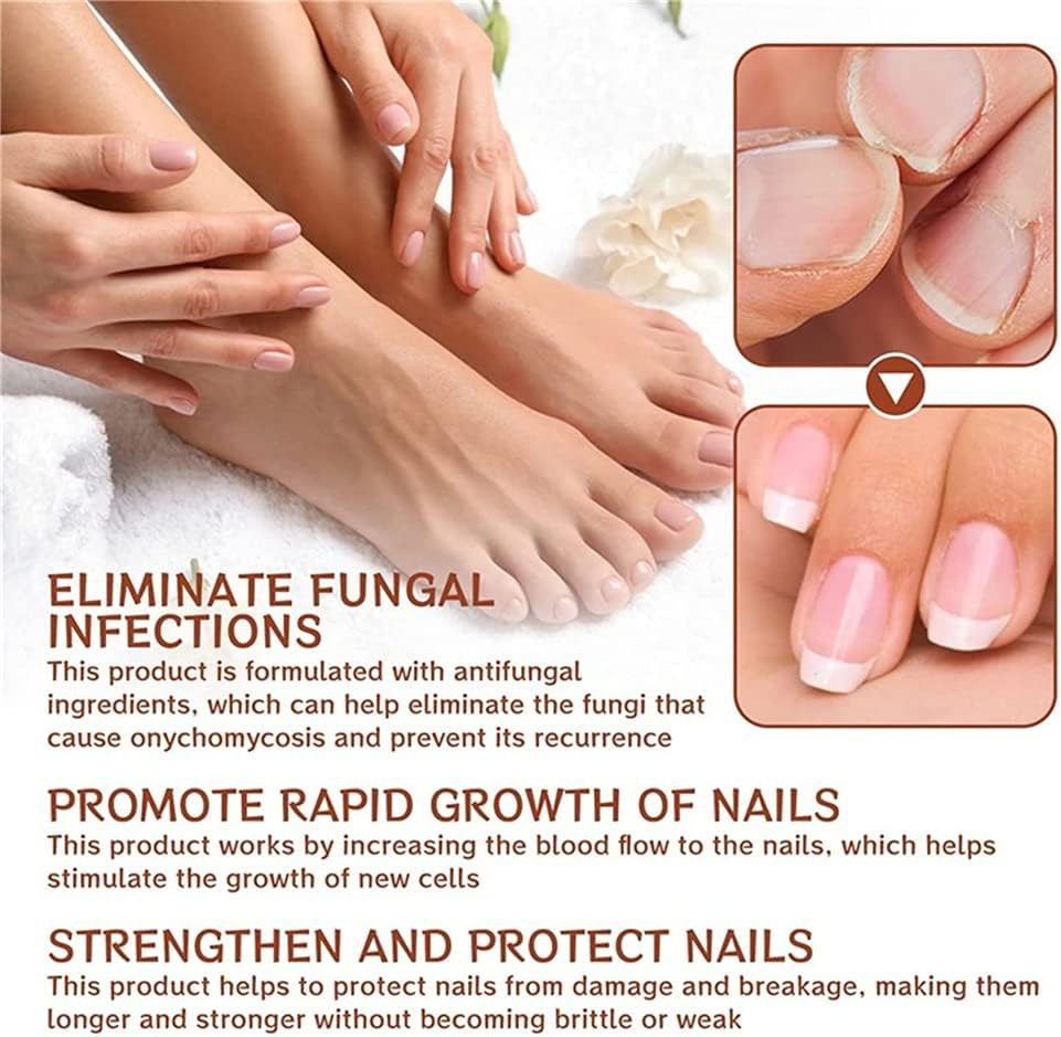 7 Days Nail Growth and Strengthening Serum, 20Ml Nail Growth and Strength Serum, Nail Growth & Strengthening Oil Serum, Stronger Nails in 1 Week Nail Strengthening Treatment (1Pcs) - 1Pcs image number 4