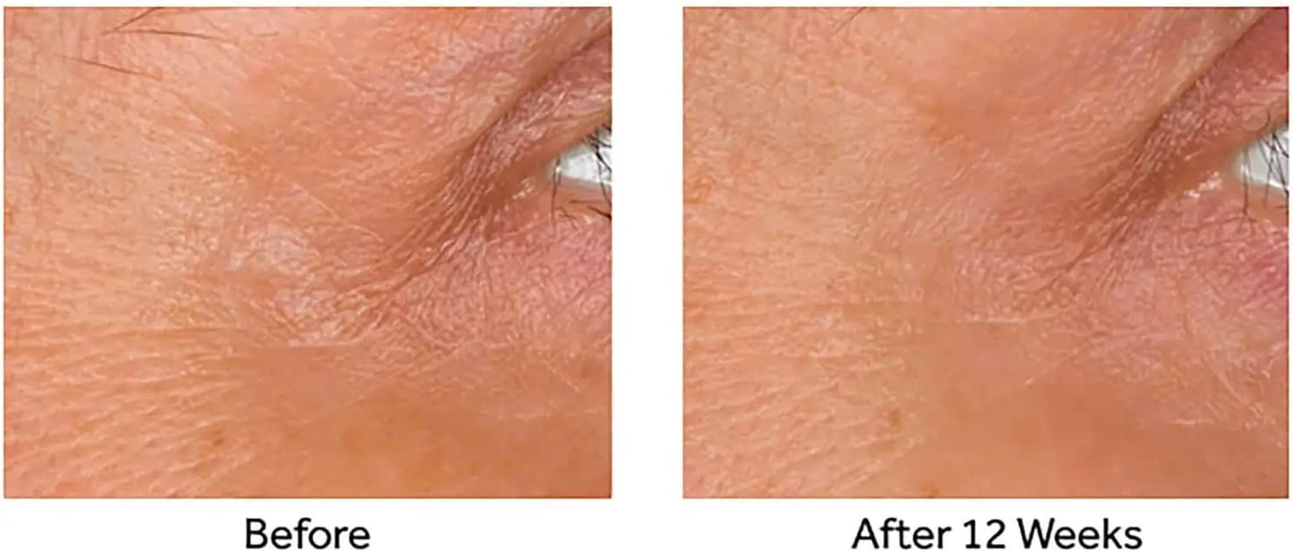 NO 7 No7 Laboratories LINE CORRECTING Booster Serum 0.5 Oz 1 Pack image number 4