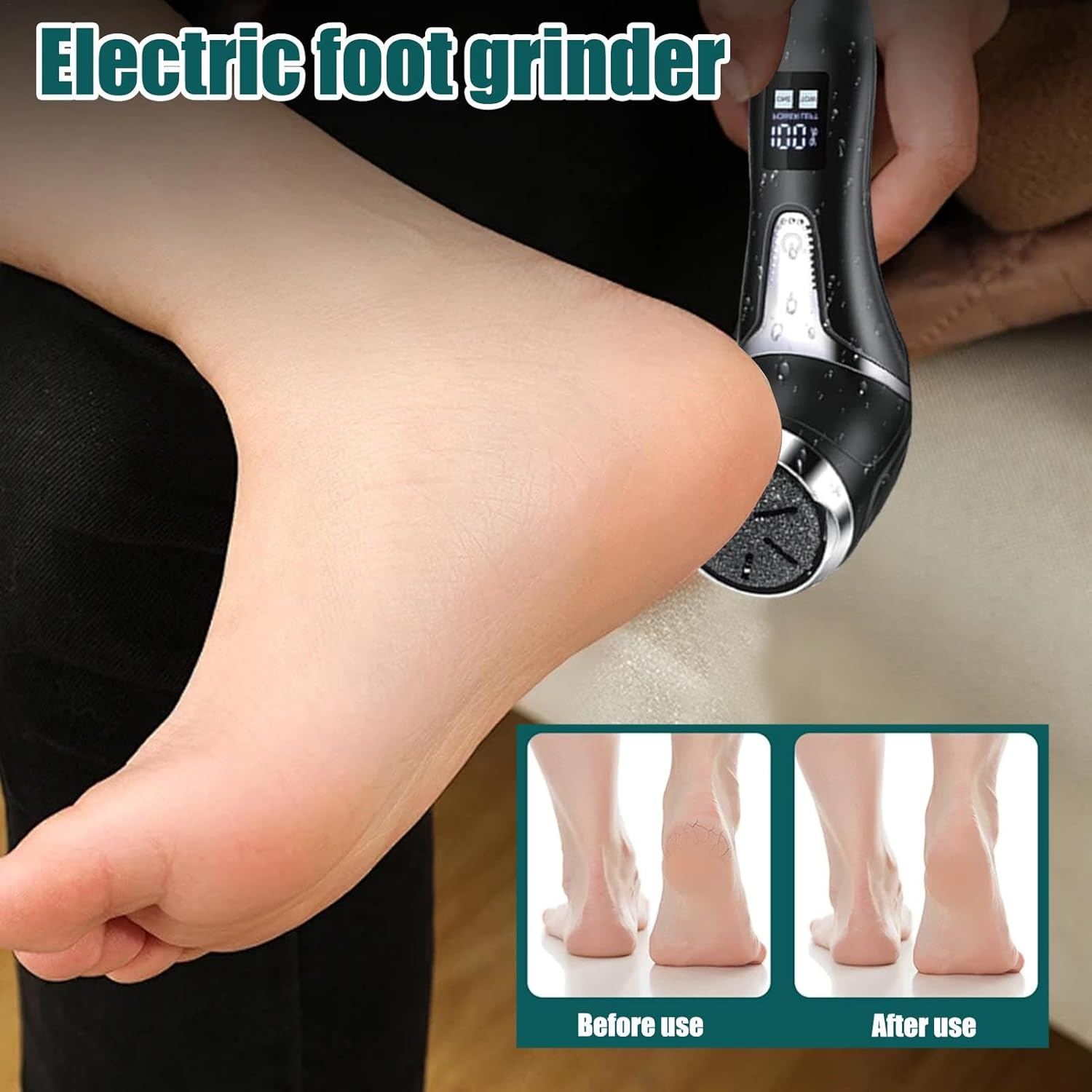 Eoixuqba Electric Foot File Manicure Pedicure Tool - Electric Foot Grinder - LED Display Professional Feet Tools for Dead, Hard Cracked Dry Skin image number 1