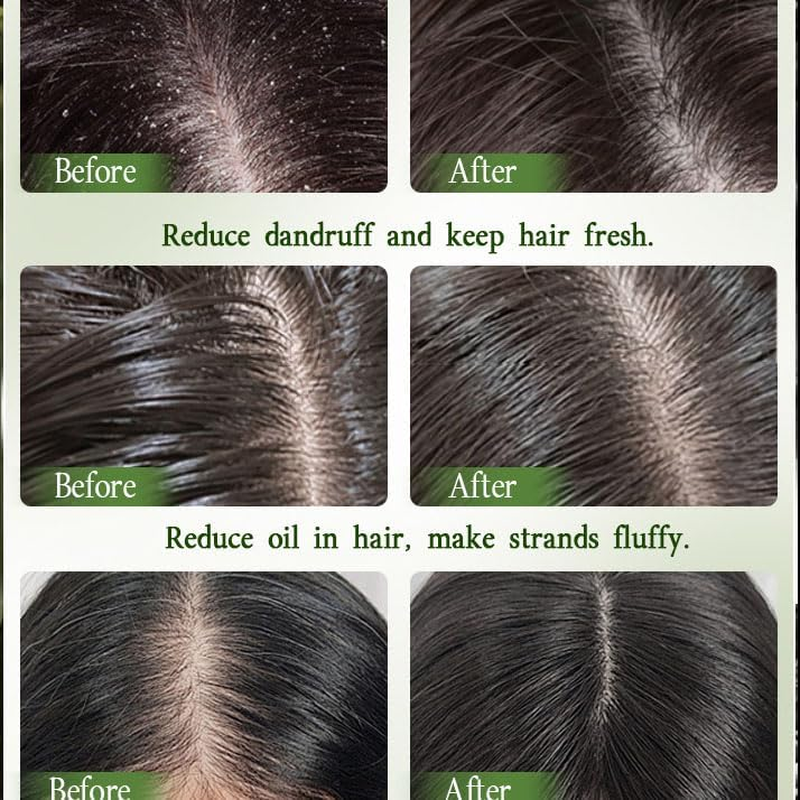 Nature Triangle Shampoo Bar, and Platycladus Orientalis Leaf & Usman Shampoo Bars to Promote Hair Growth, Strengthen and Smooth Hair for Women & Men (1PCSF) image number 1