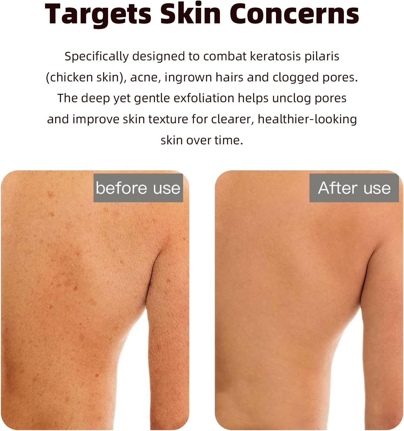 Luojinluoda Korean Exfoliating Mitts Body Scrub Glove - Premium Kessa Exfoliating Glove for Deep Cleaning, Dual-Sided Body Scrubber for Women/Men, Dead Skin Remover Spa Essential, Self-Tan Removal (Black) image number 1