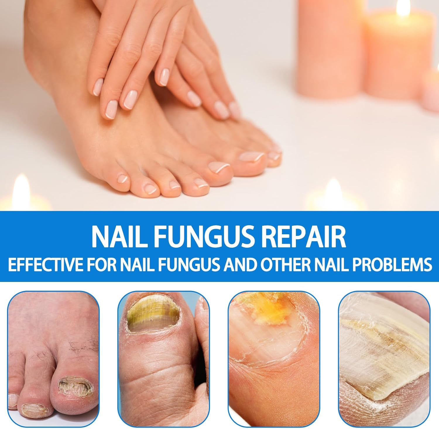 32 Pcs Fungal Nail Patches, Overnight Nail Repair Patches for Long-Term Fungal Toenail Treatment, Toenail Fungus Treatment for Healthy-Looking Nails image number 1