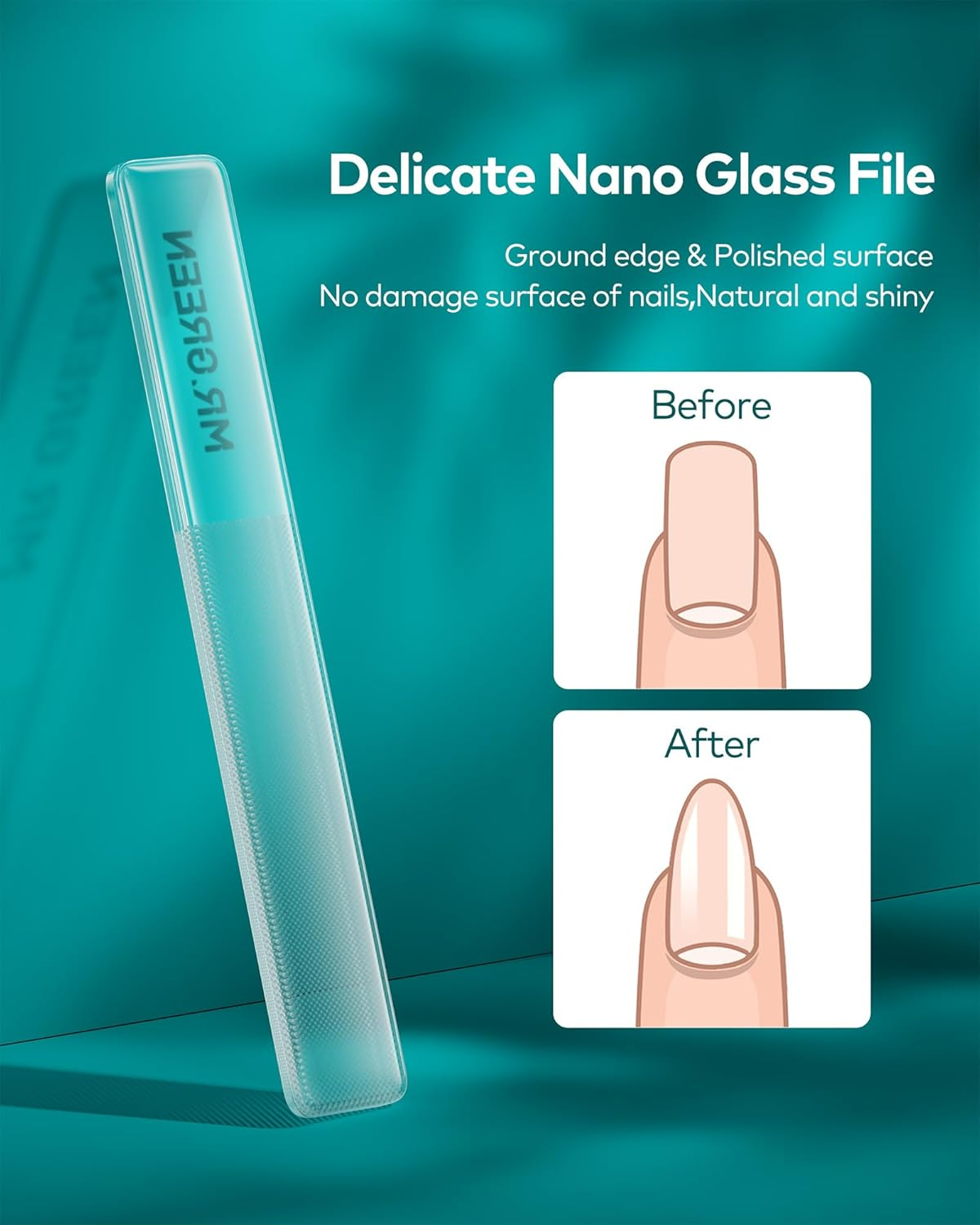 MR.GREEN 3Pcs Nail Clippers Set, German Stainless Nail Clippers with Nail File, anti Splash Nail Clippers with Catcher, Professional Finger&Toe Nail Clippers with Exquisite Leather Case for Men &Women image number 4