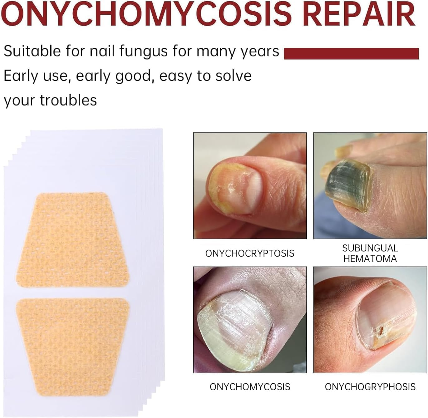 32PCS Fungal Nail Patches,Toe Nail Fungus Treatment, Nail Fungal Patches for Toenail,Nail Fungus Treatment,Yellow Toenail Patch for Fungi Nail,Nail Fungus Plasters, Active Nail Repair & Care image number 1