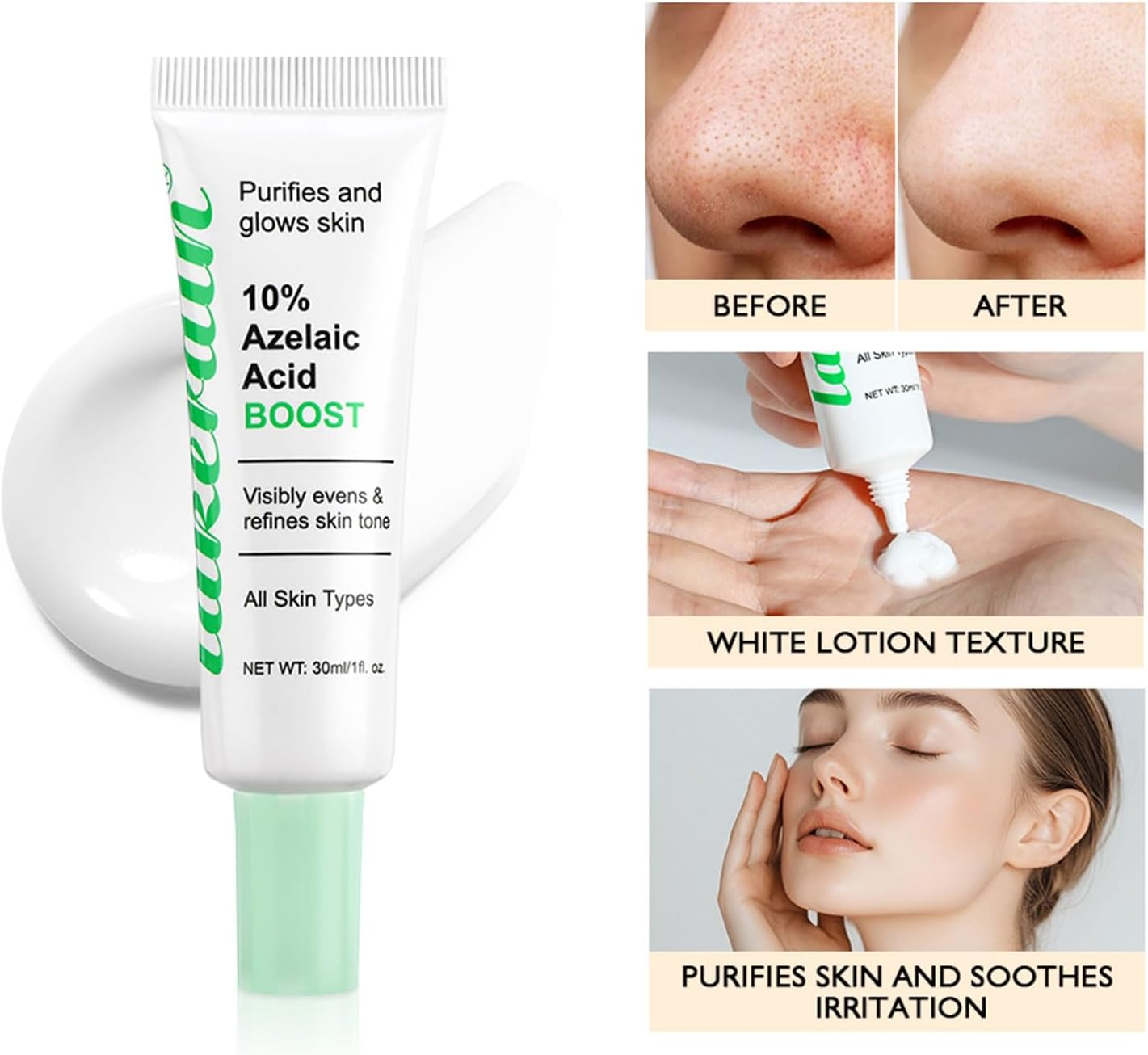 Azelaic Acid Booster Cream Gel for Face and Skin Balance Moisturizer and Nourishing Facial Skin Beauty Care for Sensitive Skin(Getaria, 10% Azelaic Acid) image number 4