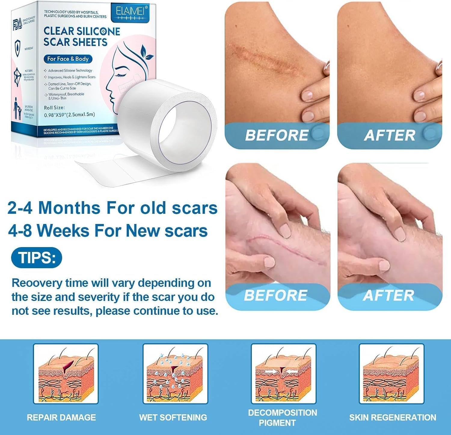 Silicone Scar Sheets, Professional Scar Tape(2.5 X 150Cm Roll-1.5M), Reusable Scar Removal Sheets, Soft Easy-Tear Silicone Scar Tape for for C-Section, Surgery, Burn, Acne Etc image number 3