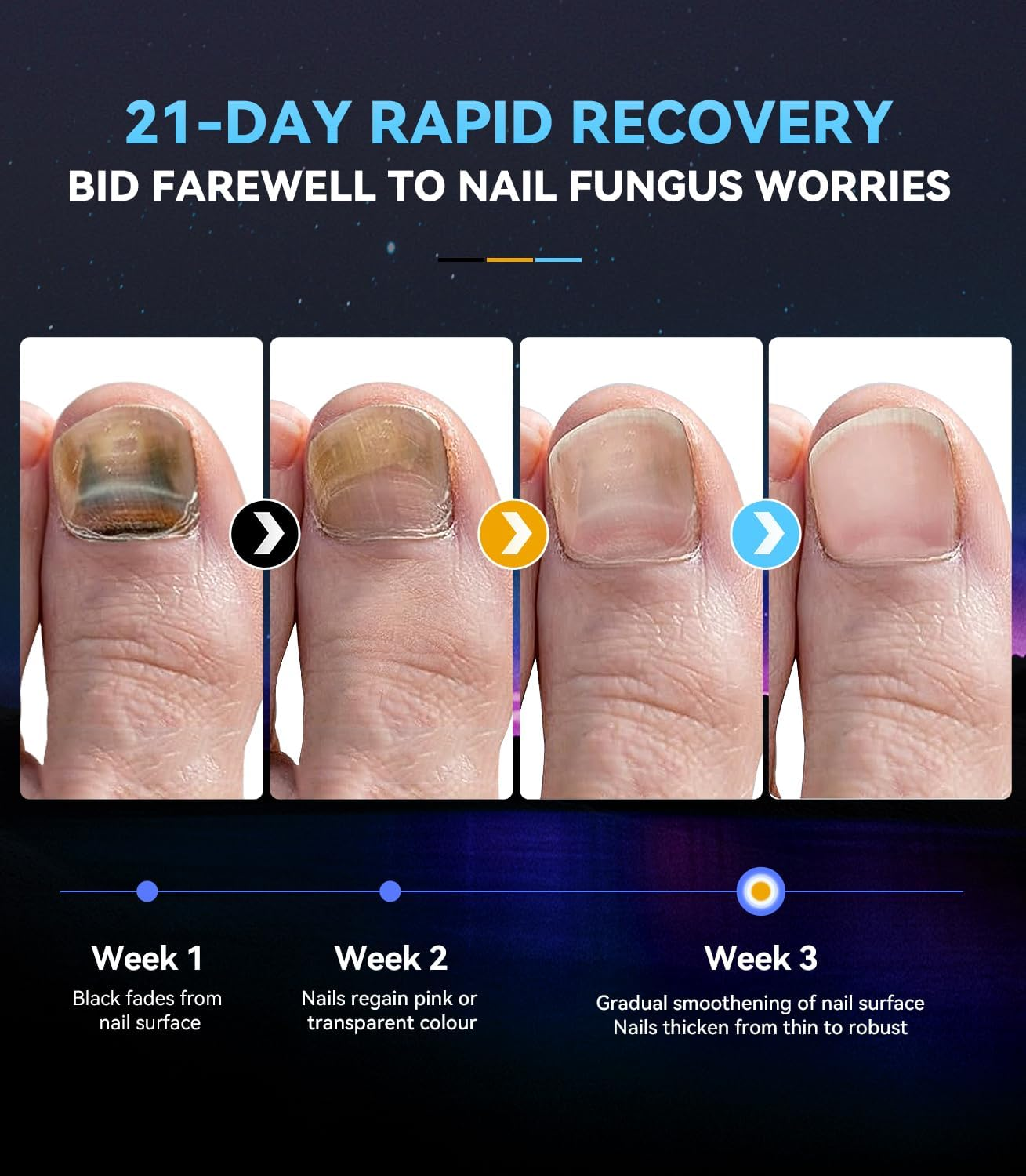 2025 Top Upgrade Nail Pil Laser Device Pain Free/Intelligent Time Control 30S/60S/99S 365Nm Infrared Light 405Nm Blue Portable Nail Tool for Fingers and Toenails