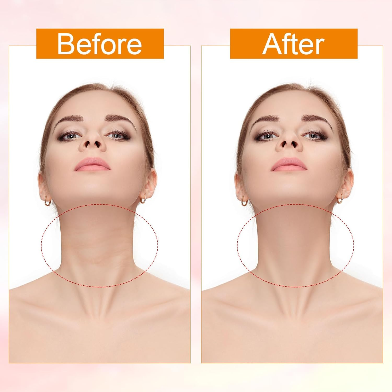 Sinbana 8Pcs Neck Lift Tape, 2 Styles Invisible Instant Lifting Firming Tape with 40Pcs Replacement Patches Double Chin & Saggy Skin High Elastic Breathable Waterproof Neck Wrinkle Solution image number 2