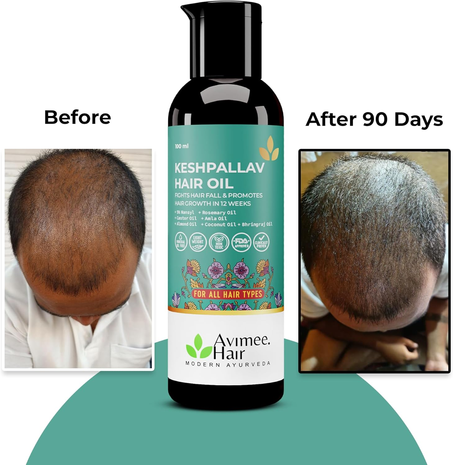 AVIMEE Herbalkeshpallav Hair Oil for Men & Women | Promotes Hair Growth & Reduces Hair Fall | with Rosemary, Castor, Amla, Coconut and Bhringraj Oil | Mineral Oil Free (Pack of 2)