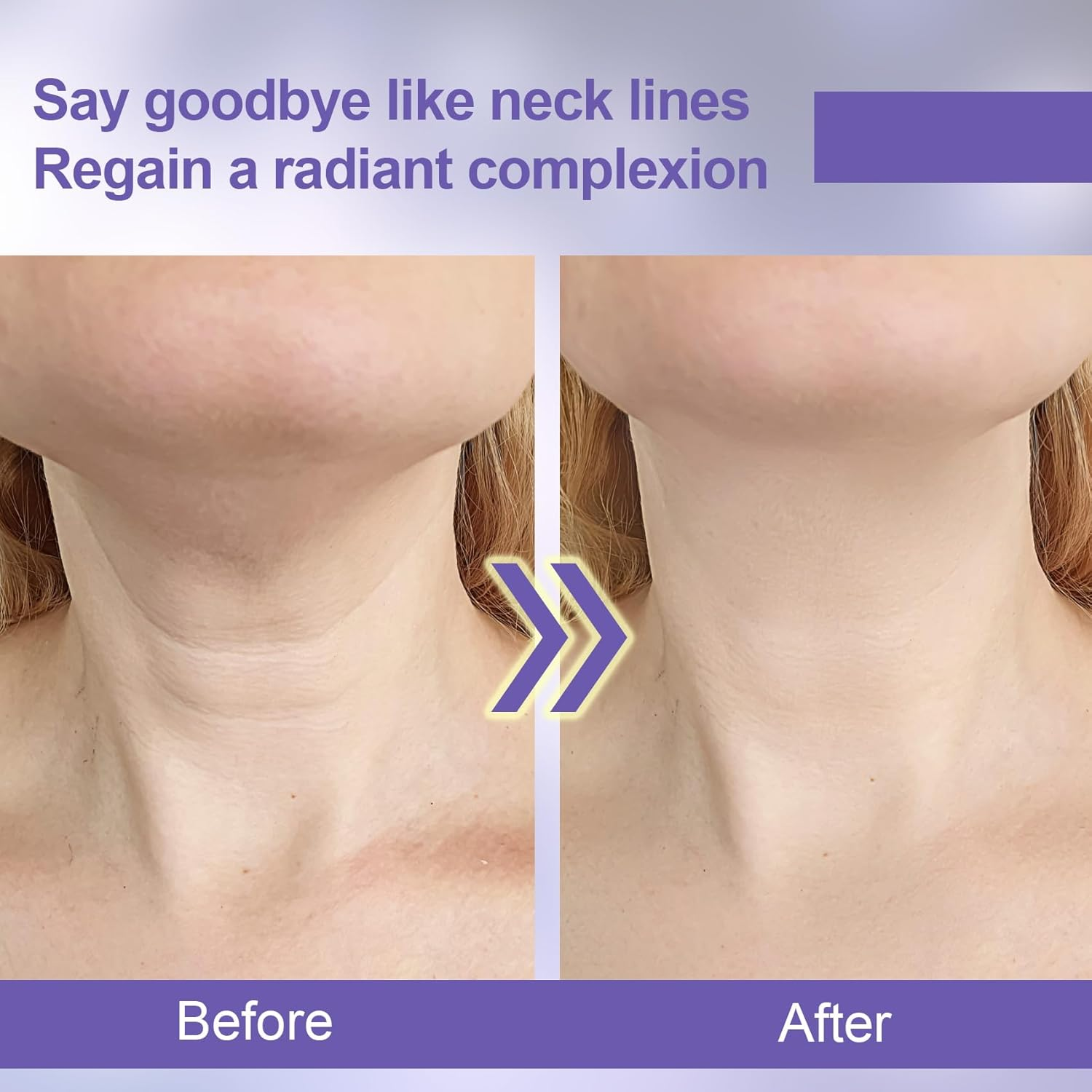 Alpinleux 20 Pcs Instant Neck Lift Tape, Neck Tape Lifting Invisible, Breathable Neck Tape, Self-Adhesive Neck Lift Tape Invisible behind Neck (Skin Color) image number 2