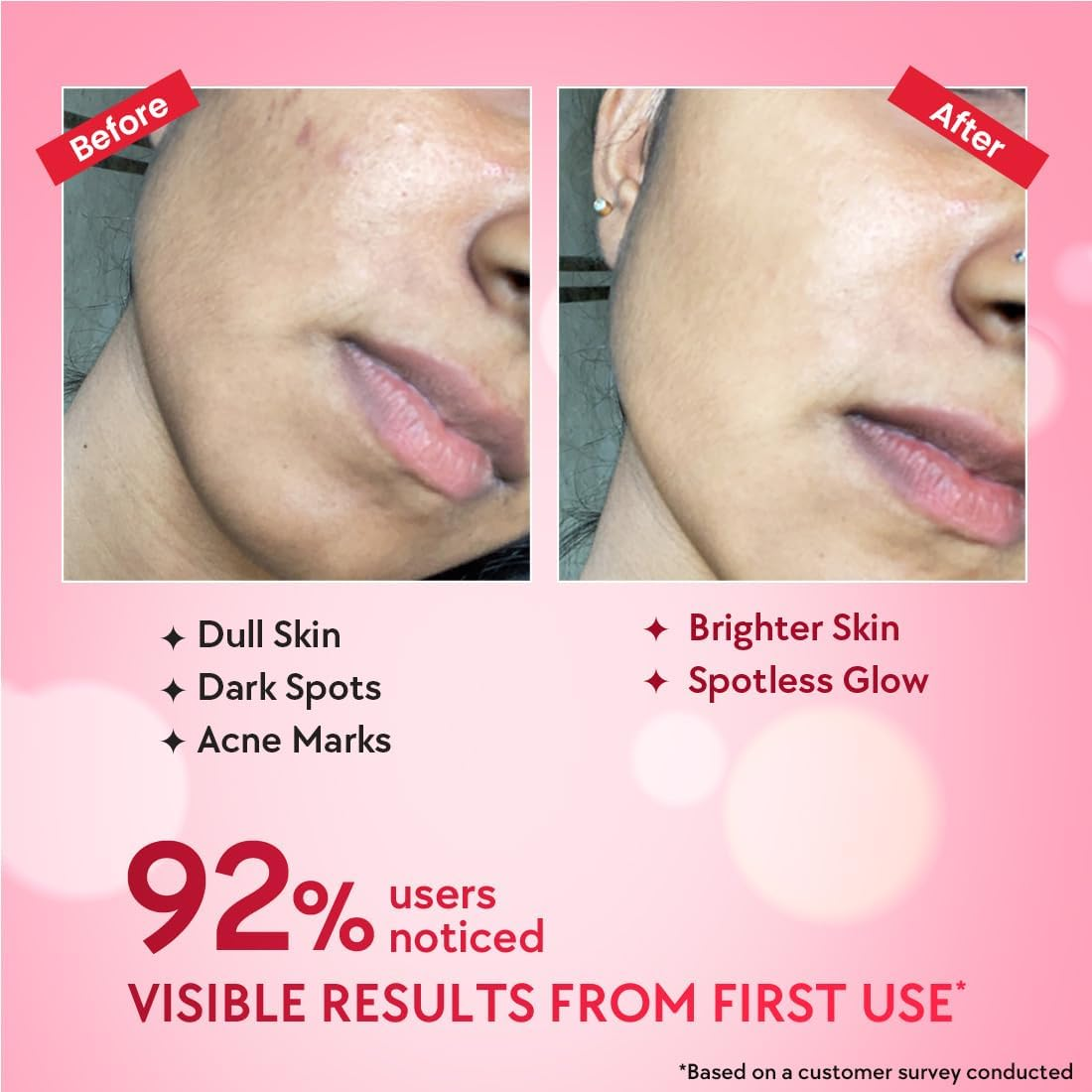 Chicnutrix Outshine &ndash; with Korean 2% Niacinamide + Glutathione + Vitamin C | Helps Brighten Dull Skin, Clears Dark Spots, Blemishes, Acne Marks & Pigmentation | Korean Glass Skin Serum image number 4