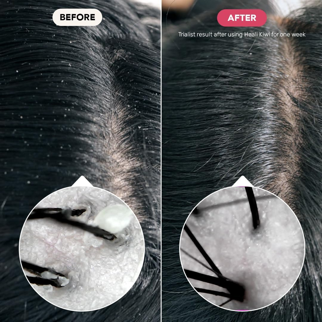 Ethique Eco-Friendly Solid Shampoo Bar, Heali Kiwi 3.88 Oz image number 4