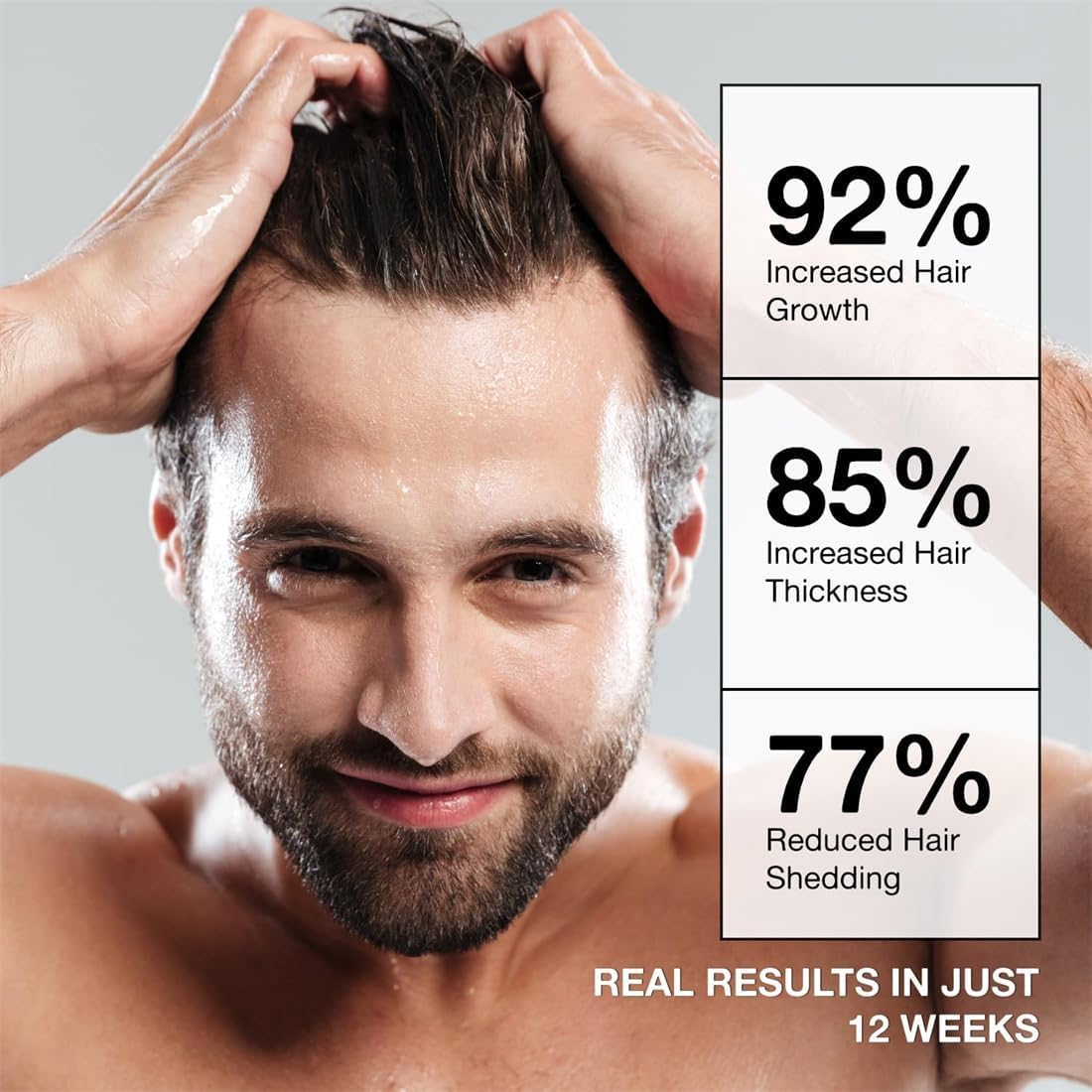 Root Activator Shampoo for Men: Hair Growth Shampoo for Hair Loss and Thinning Hair - 10.1 Fl Oz / 300 Ml image number 1