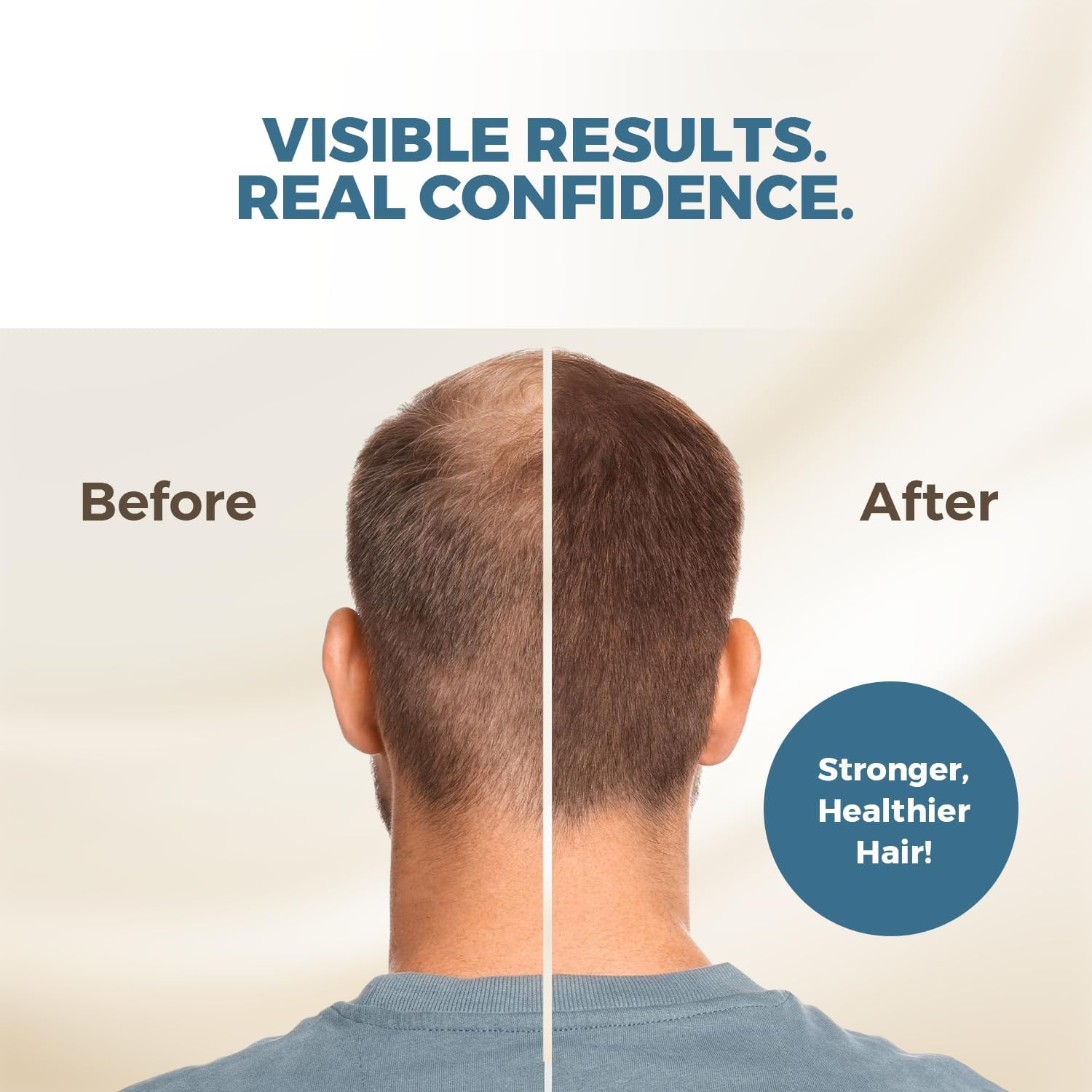 HAIRMETTO&reg; Topical Hair DHT Blocker Serum for Hair Loss, Hair Regrowth with Saw Palmetto Oil, Stinging Nettle Oil, Rosemary Oil, Soothes Dry Scalp, Non-Oily, Peppermint Scent, 4Oz Bottle image number 5