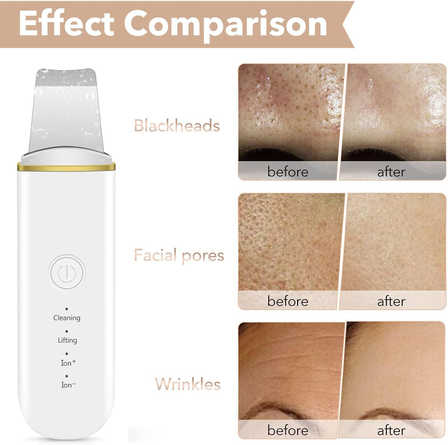 Facial Skin Scrubber, Ultrasonic Skin Spatula Face Blackhead Remover Scraper with 4 Modes, Rechargeable Pore Scrubber with 2 Silicone Covers image number 2