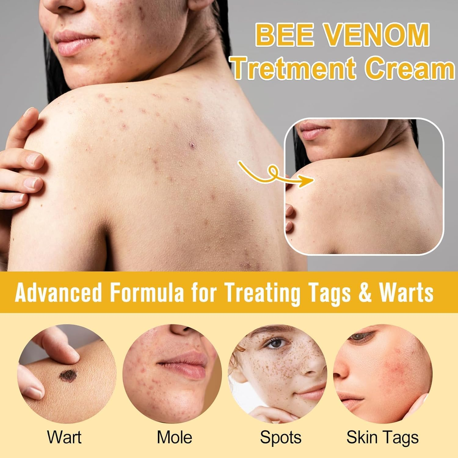 2PCS Bee Venom, Natural Bee Venom Cream for Skin New Zealand Bee Venom Repair Cream, Natural Moisturizer for All Skin Types 30Ml image number 1
