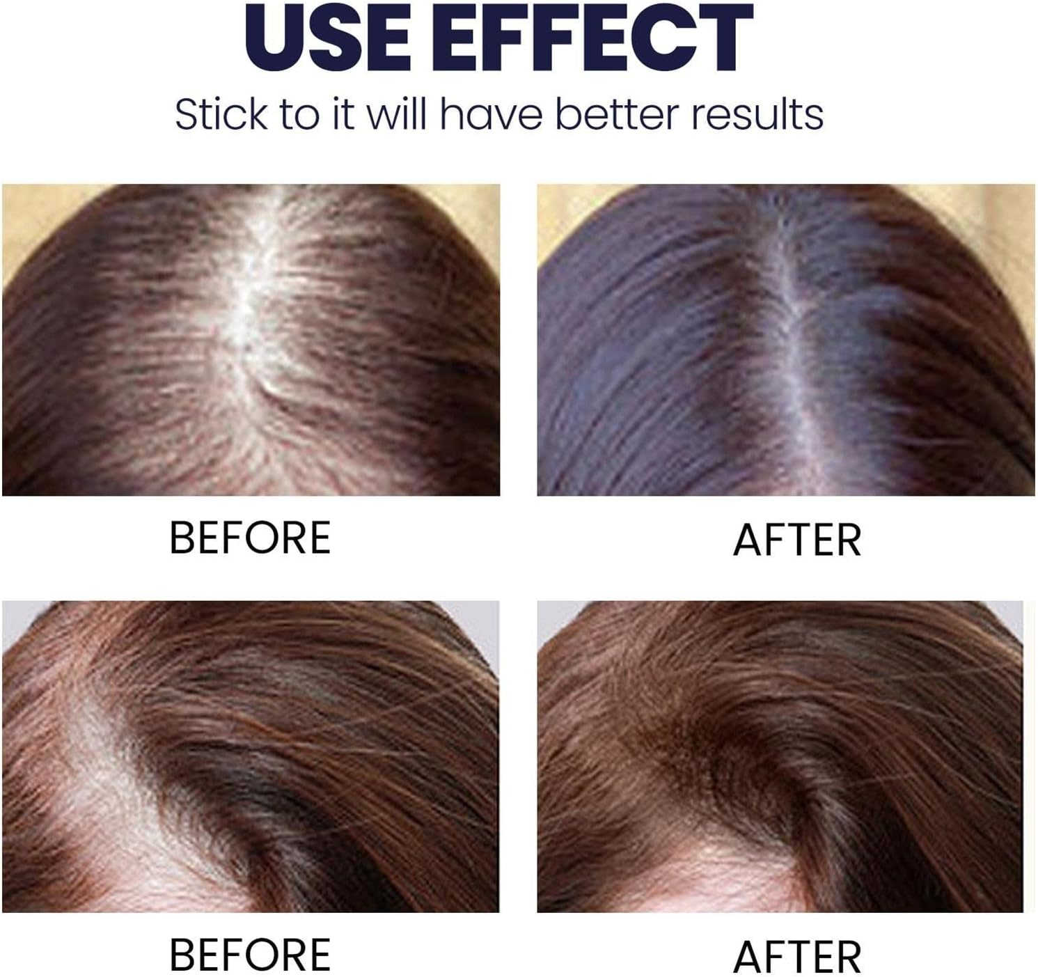 Hair Conditioner Spray,2.11Oz Hair Booster Spray | Plant Extracts Hair Regrowth Extended Nozzle Sprayer for Repairs Damaged Hair Pisole image number 5