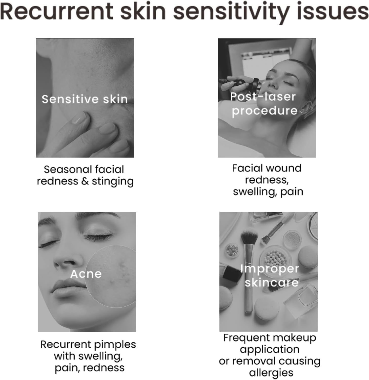 WINONA Collagen Sheet Mask 6Pcs, Recombinant Collagen Dressing, Hydrating Face Mask for Sensitive Skin, Soothes and Skin Barrier Repair, Suppresses Acne, Repair Dressing for Post-Procedure Skin image number 4