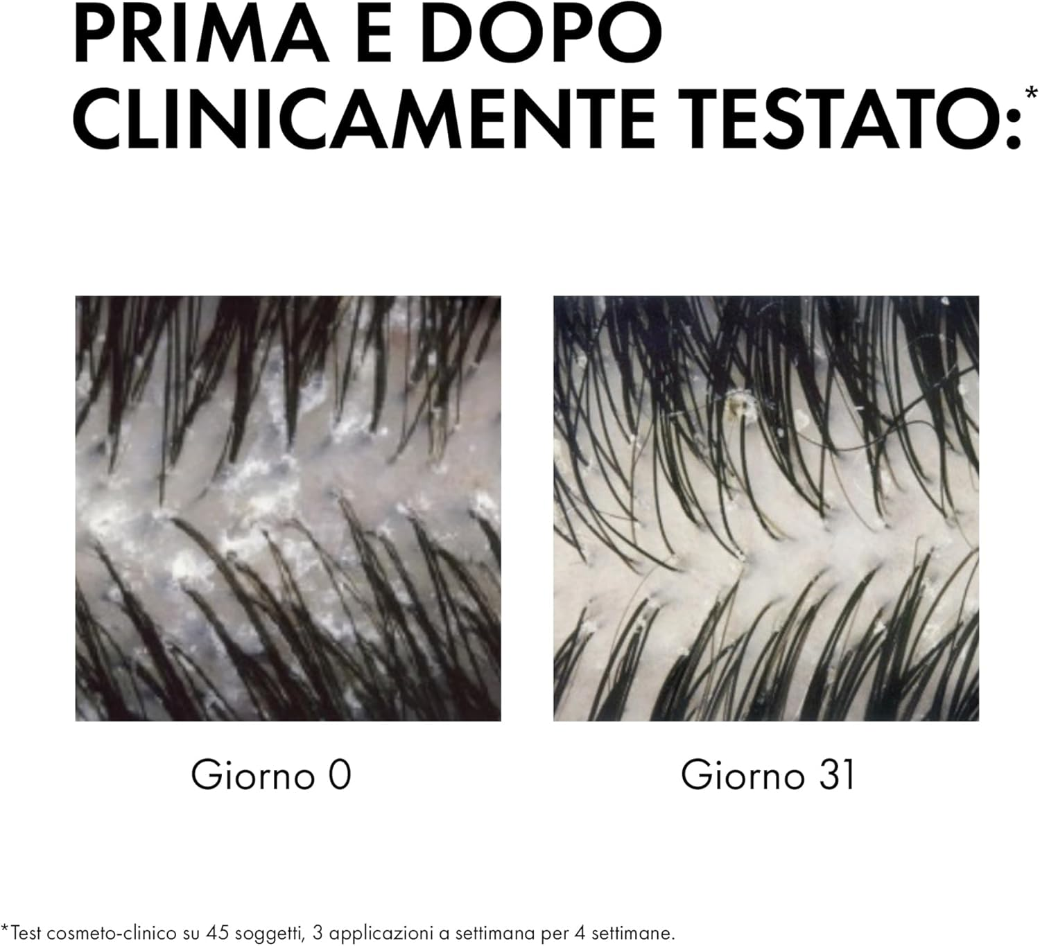 Vichy Dercos Anti-Dandruff Shampoo for Normal to Oily Hair 390Ml, DS Dermatological Shampoo for Sensitive Scalp, Dandruff & Itchy Scalp, Helps Maintain Microbiome & Eliminates Dandruff, Selenium + Salicylic Acid image number 1