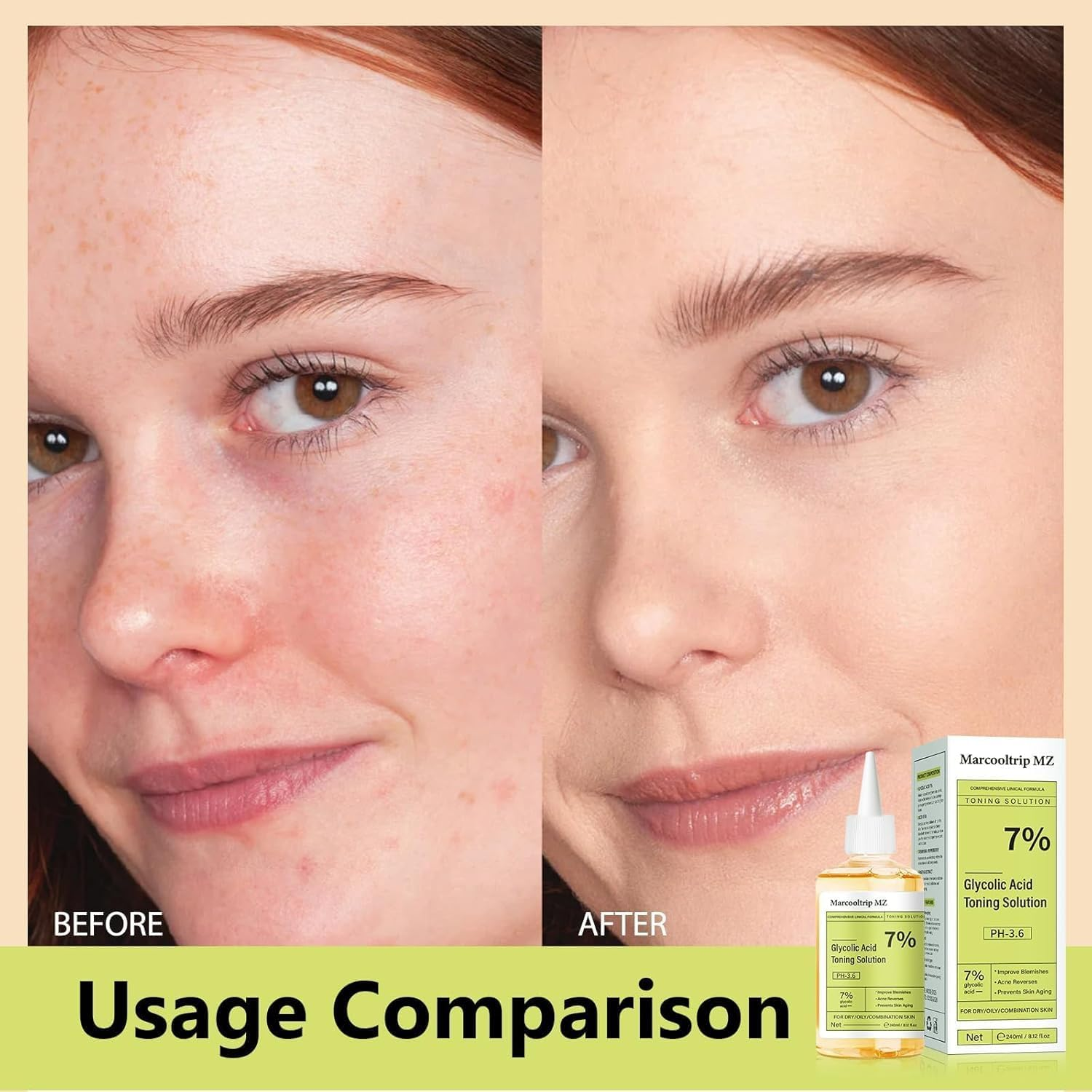 240Ml Glycolic Acid 7% Exfoliating Toner for Hydrating & Smoothening, Multi-Functional Gentle Serum for Face, Body & Underarms Skin Care