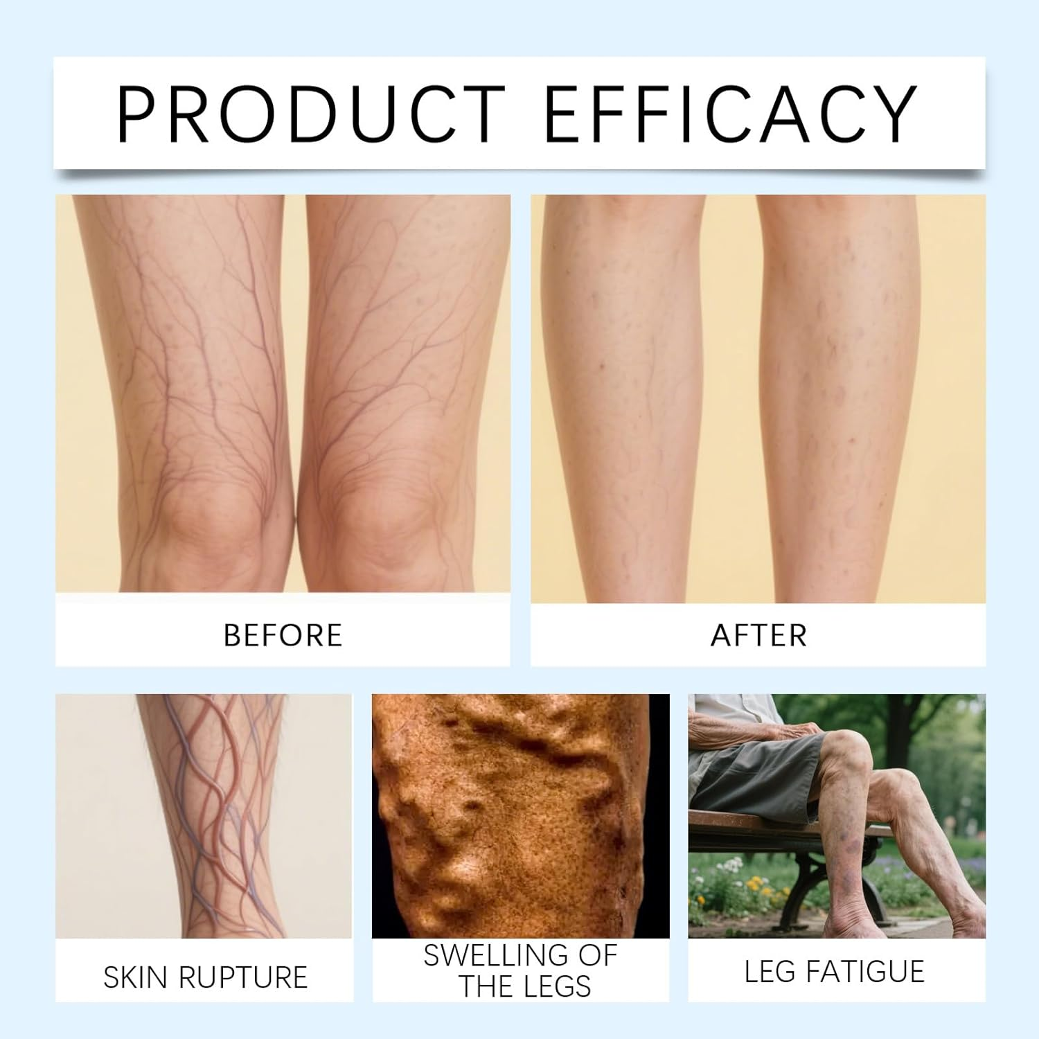 Soothing Leg Cream for Burning Sensation, Heavy & Tired Legs, Relaxing Cooling Gel for Discomfort, Moisturizing Daily Care for Long-Lasting Refreshing Comfort (2Pcs) - 1Pcs image number 3