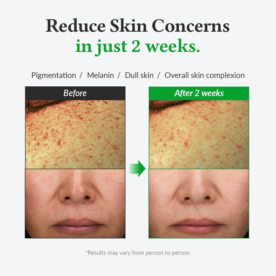 Dr.Althea Gentle Vitamin C Serum | Benefits Skin Tone and Pigmentation | Gentle on Skin for Even Skin Tone | Korean Vegan Skin Care for All Skin Types image number 1