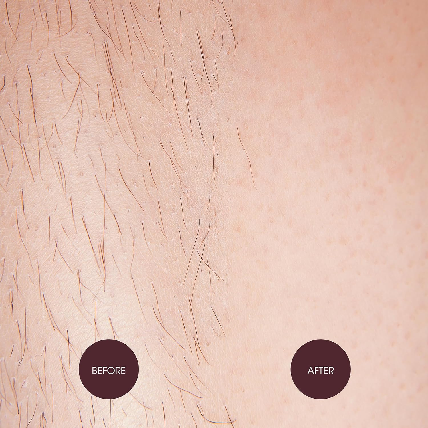 Nad'S Sensitive Hair Removal Cream for Body and Legs, 150Ml image number 1