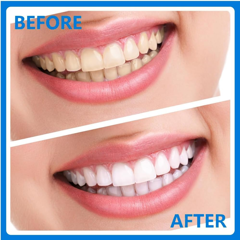 Dental Set Teeth Whitening Hygiene Kit 4Pcs Dentist Tools Set for Home Use Stainless Steel Mouth Mirror Tweezers Dental Picks Oral Care Set to Remover Tartar, Tooth Scraper