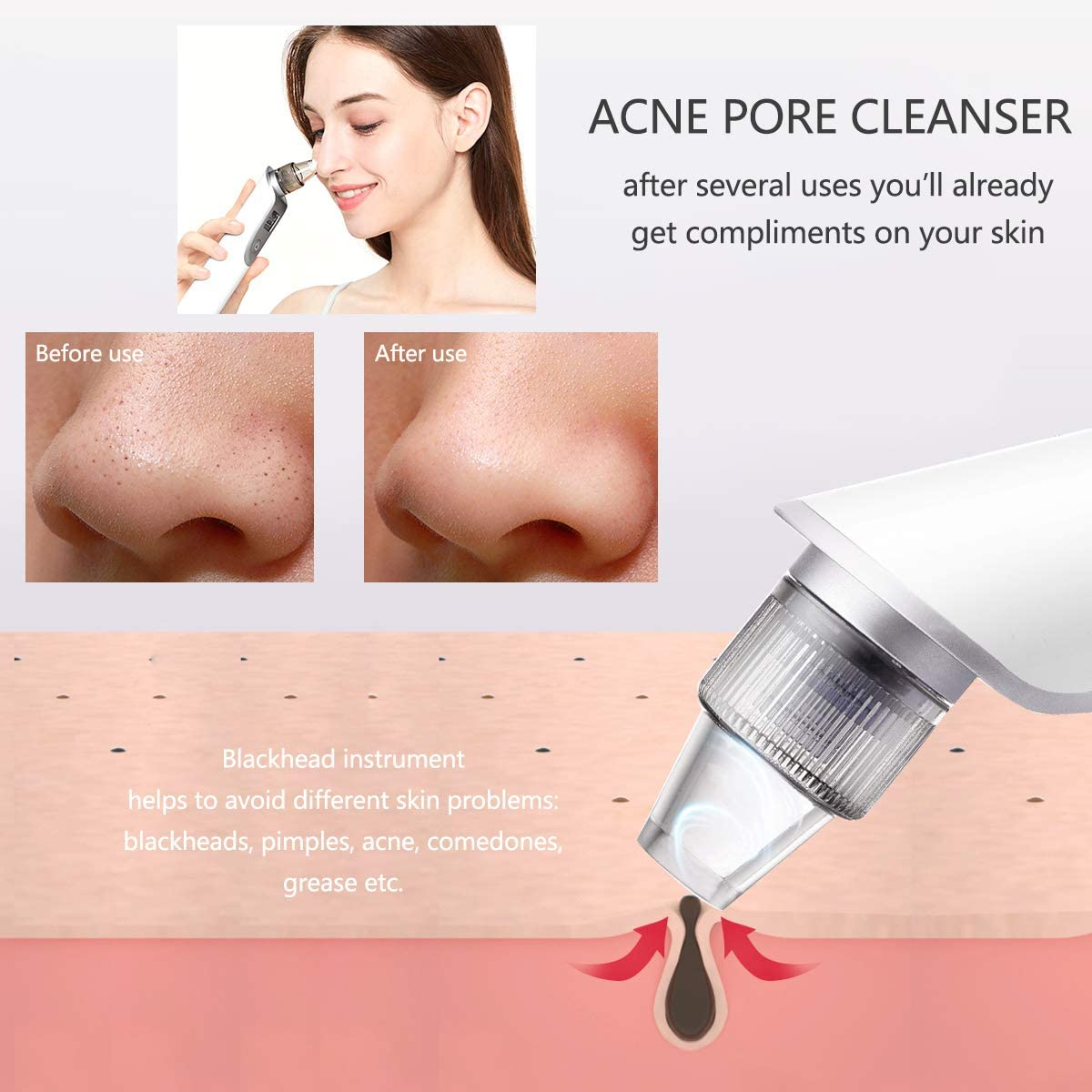 X7 Blackheads Remover, Blue and Red Light Beauty Instrument Facial Skin Care Tools with LED Display image number 6