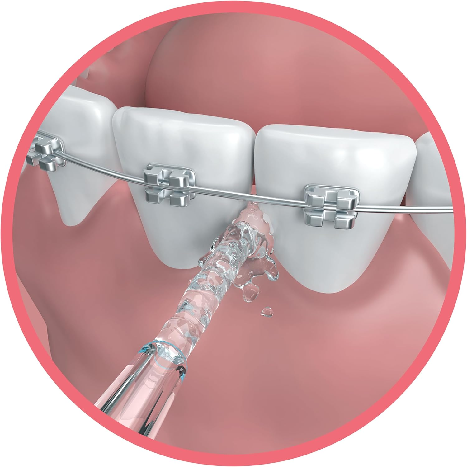 GO2 Dentagenie Water Flosser Replacement Nozzle Family Pk