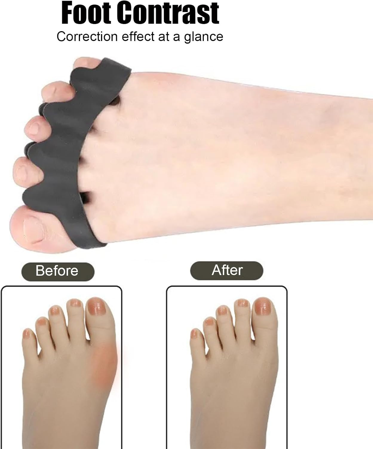Vonzuda 2 Pairs Toe Separators for Women and Men，Soft Gel Toe Spacers to Correct Bunion, Relieve Feet Pain, Foot Alignment, Toe Straighteners for Hammer & Claw Toes, Plantar Fasciitis (Black+White) image number 2