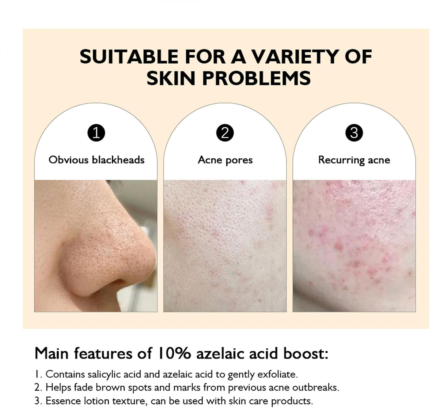 Azelaic Acid Booster Cream Gel for Face and Skin Balance Moisturizer and Nourishing Facial Skin Beauty Care for Sensitive Skin(Getaria, 10% Azelaic Acid) image number 6