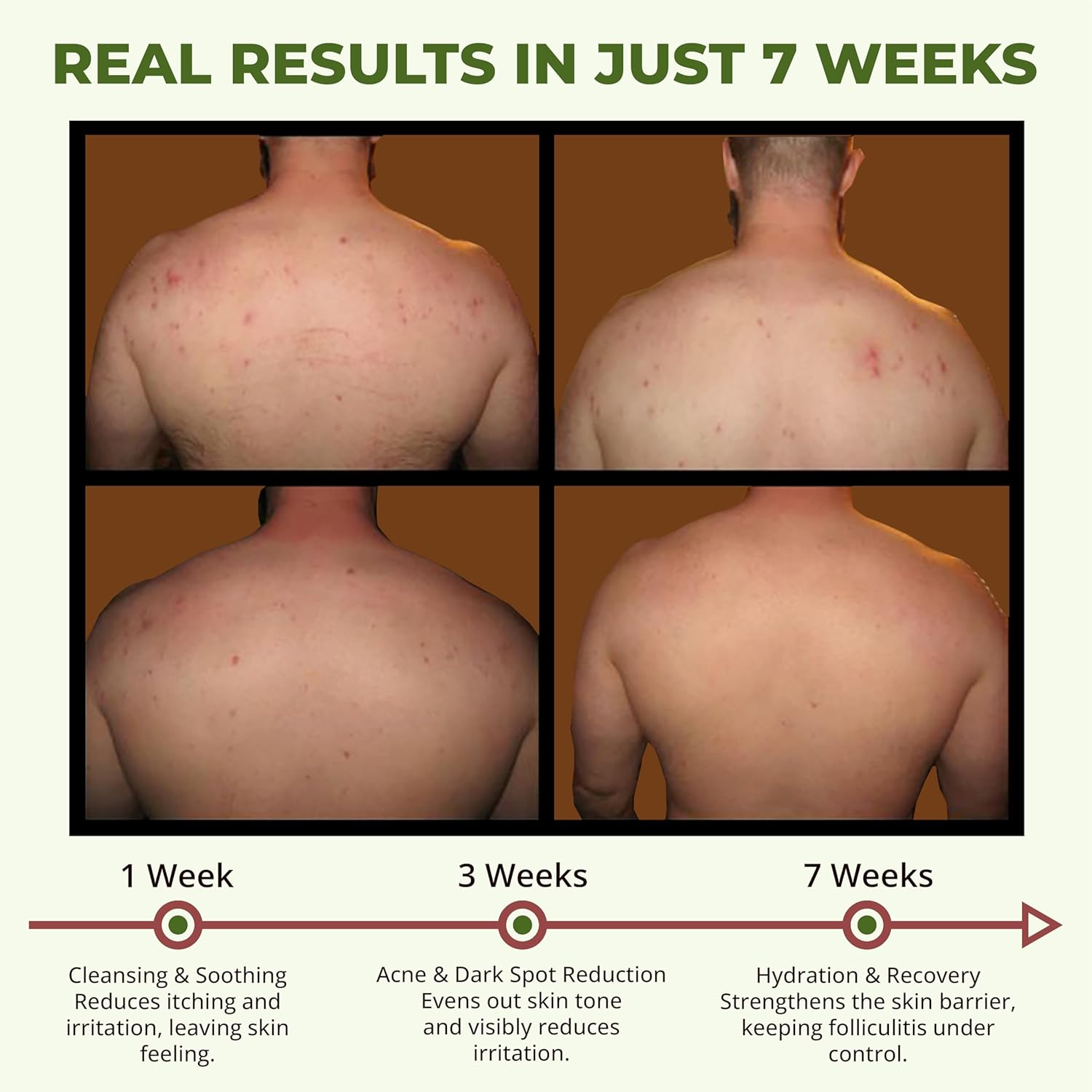 ABERA BHA Body Wash for Folliculitis & Body Acne &ndash; Wild Bitter Melon Extract, Exfoliating Shower Gel for Clear & Smooth Skin, 300Ml image number 3