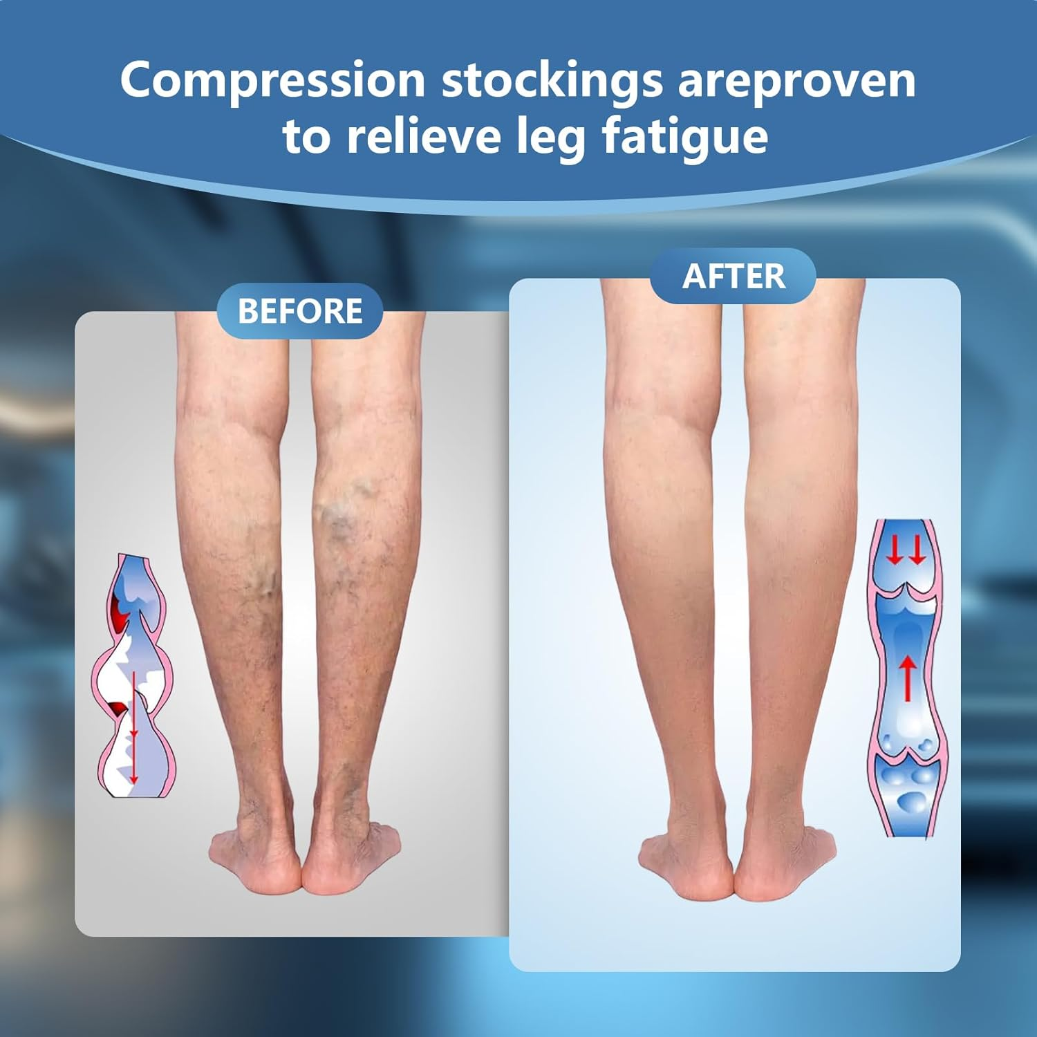 Viiotu Open Toe Compression Socks for Men & Women - 2 Pairs 15-20 Mmhg Knee High Flight & Travel Socks for Circulation Support image number 3