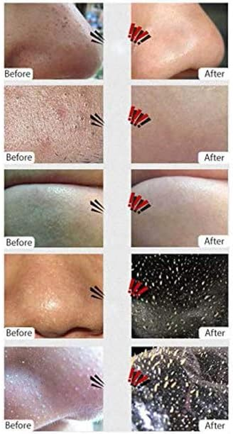 Aichun Beauty Blackhead Remover Black Mask Deep Cleansing Peel-Off Mask for Blackheads Remove,Tearing Style Deep Cleansing Purifying - Activated Charcoal, 50Gram image number 2