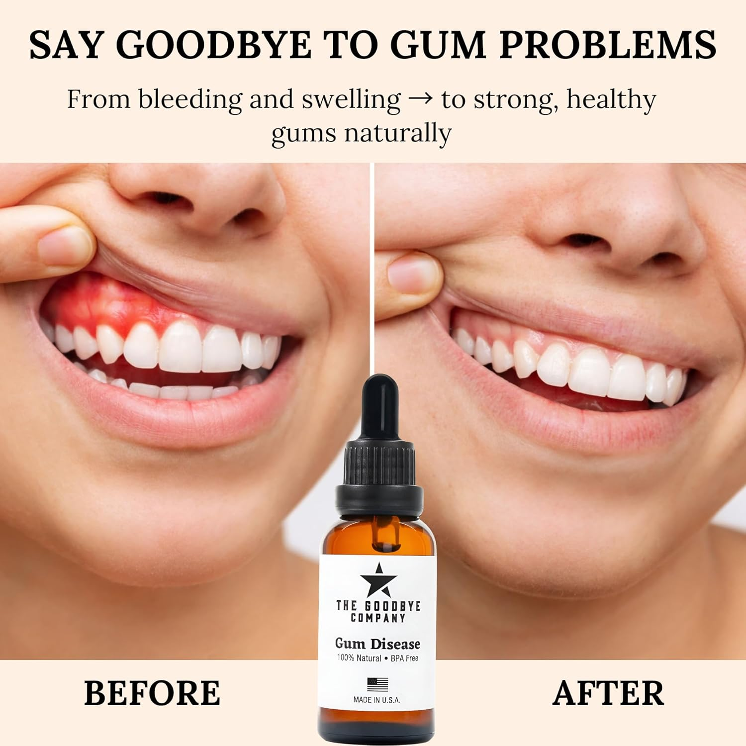 Goodbye Gum Disease - Organic Home Remedy for Oral Gum Disease | 100% Pure Neem and Clove Essential Oils for Oral Care | Effective and Natural Gingivitis Treatment image number 6