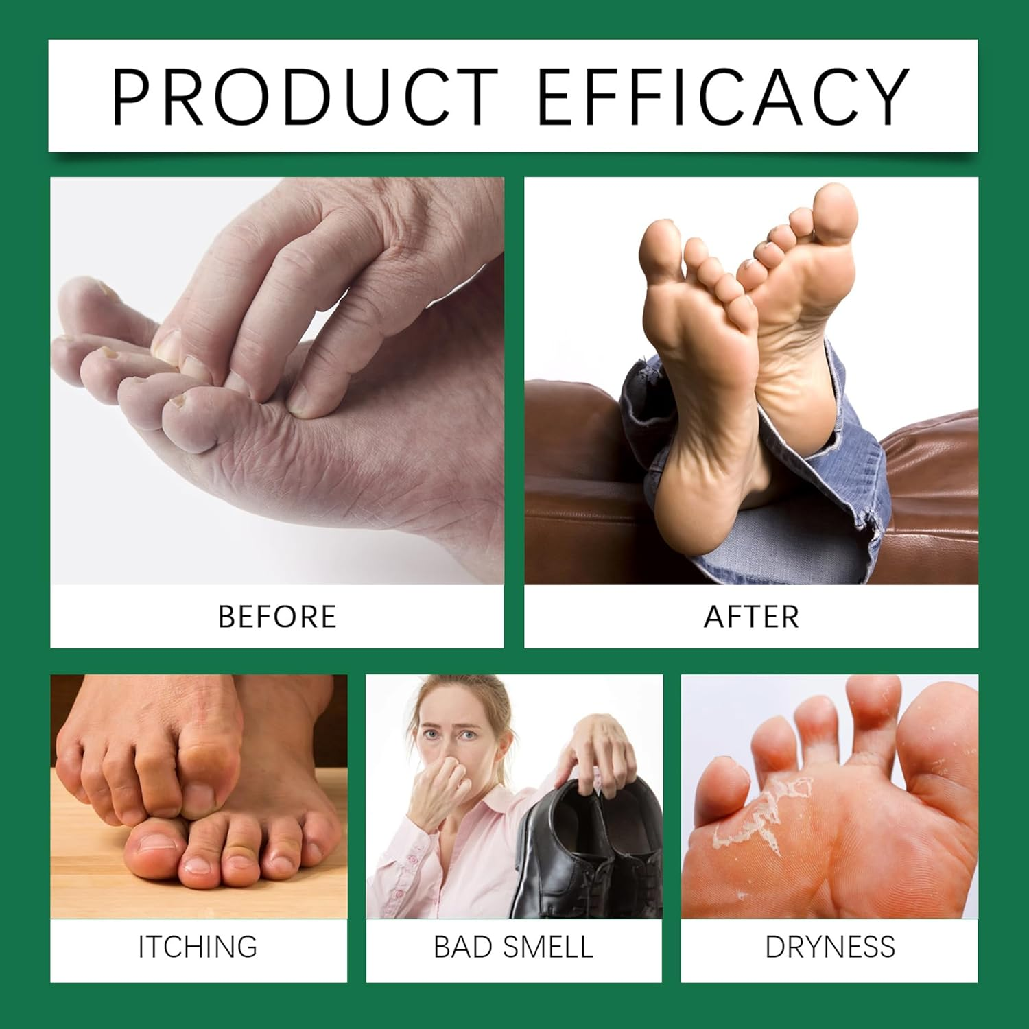 Foot Care Spray - Helps Reduce Odor - the Spray Has a Better Refreshing Effect - Suitable for Feet or Soles. image number 1