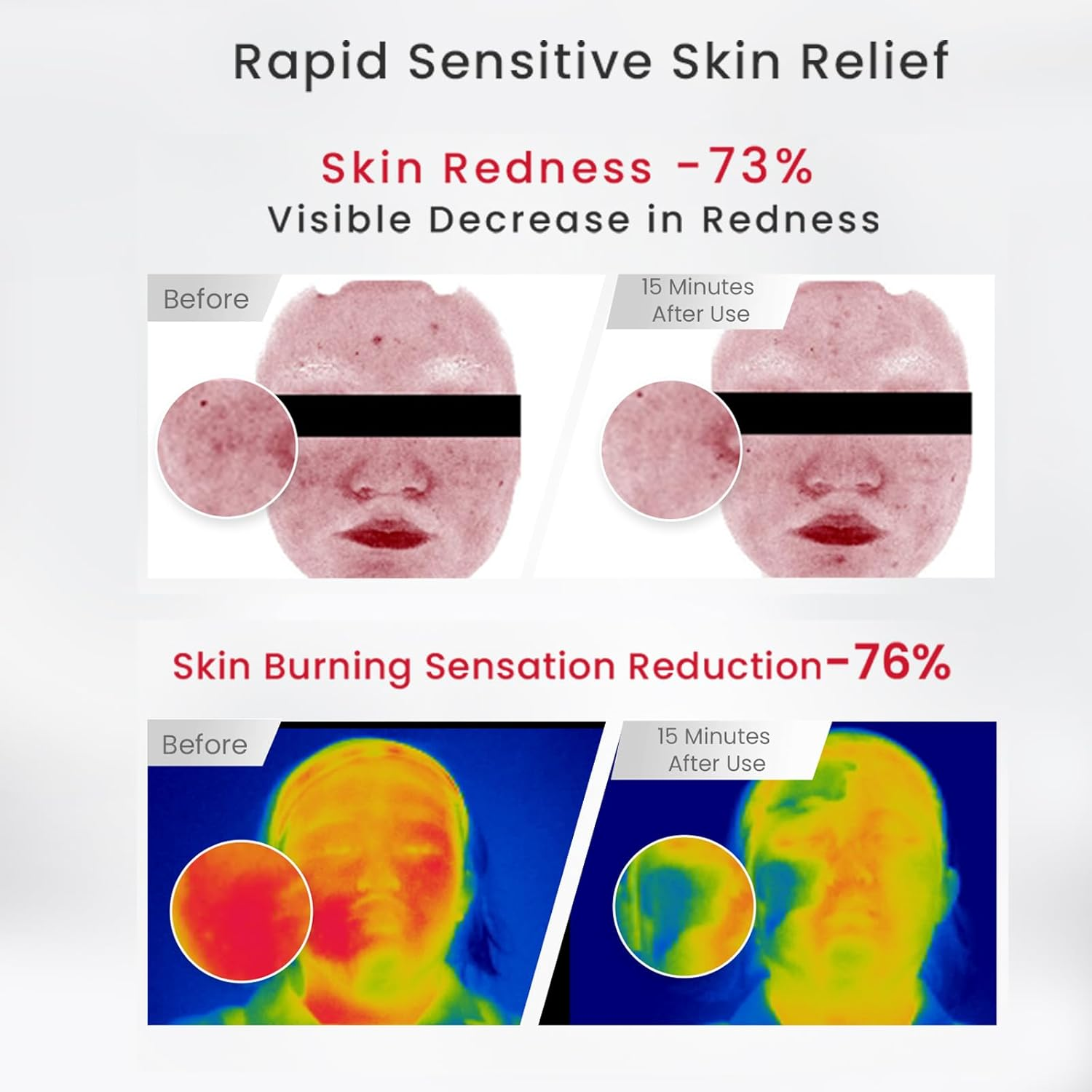 WINONA Face Moisturiser for Sensitive Skin, Soothing Hydrating Cream with Barrier Repair, Helps Calm Redness & Irritation, Lightweight Moisture for All-Day Comfort, 50G