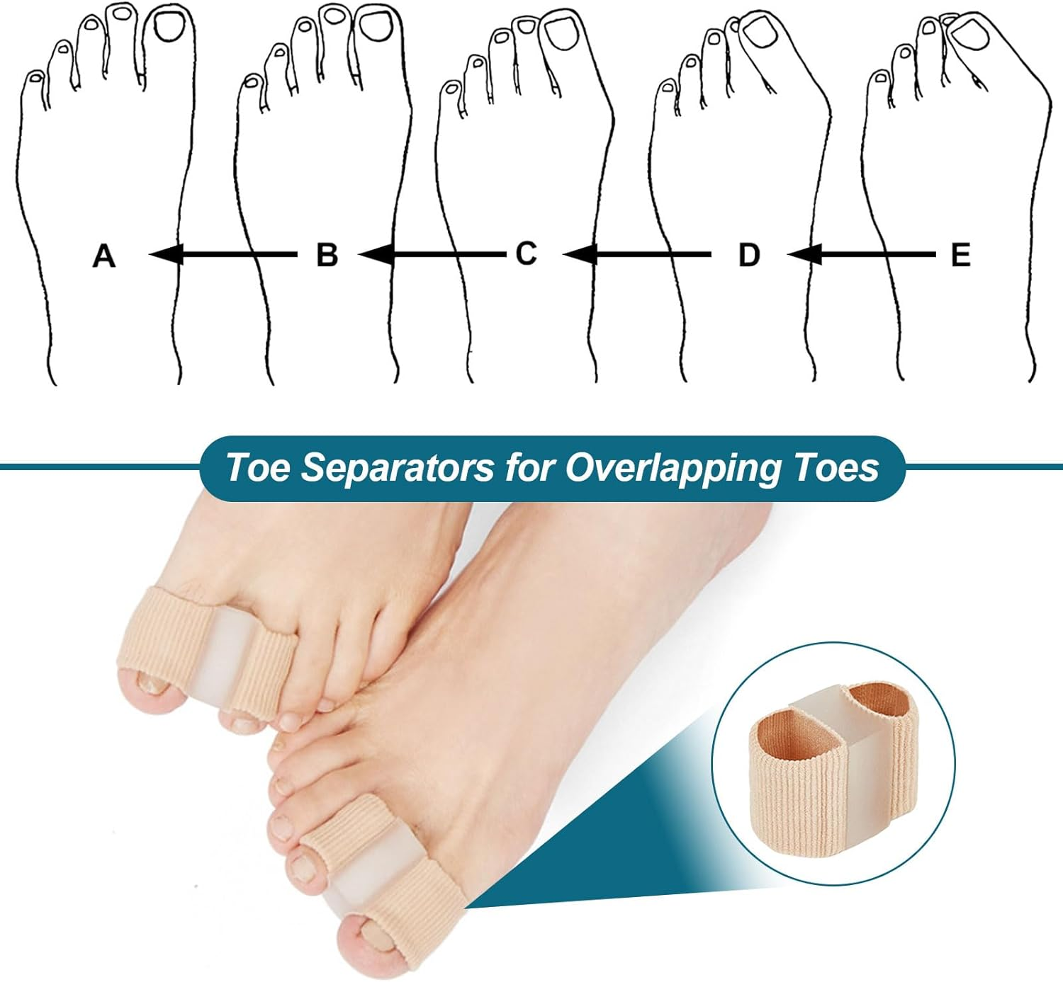6 Pack Toe Separators, Bunion Corrector for Women Men, Hammer Big Toe Straightener for Overlapping Breathable and Bunion Pain Relief image number 5