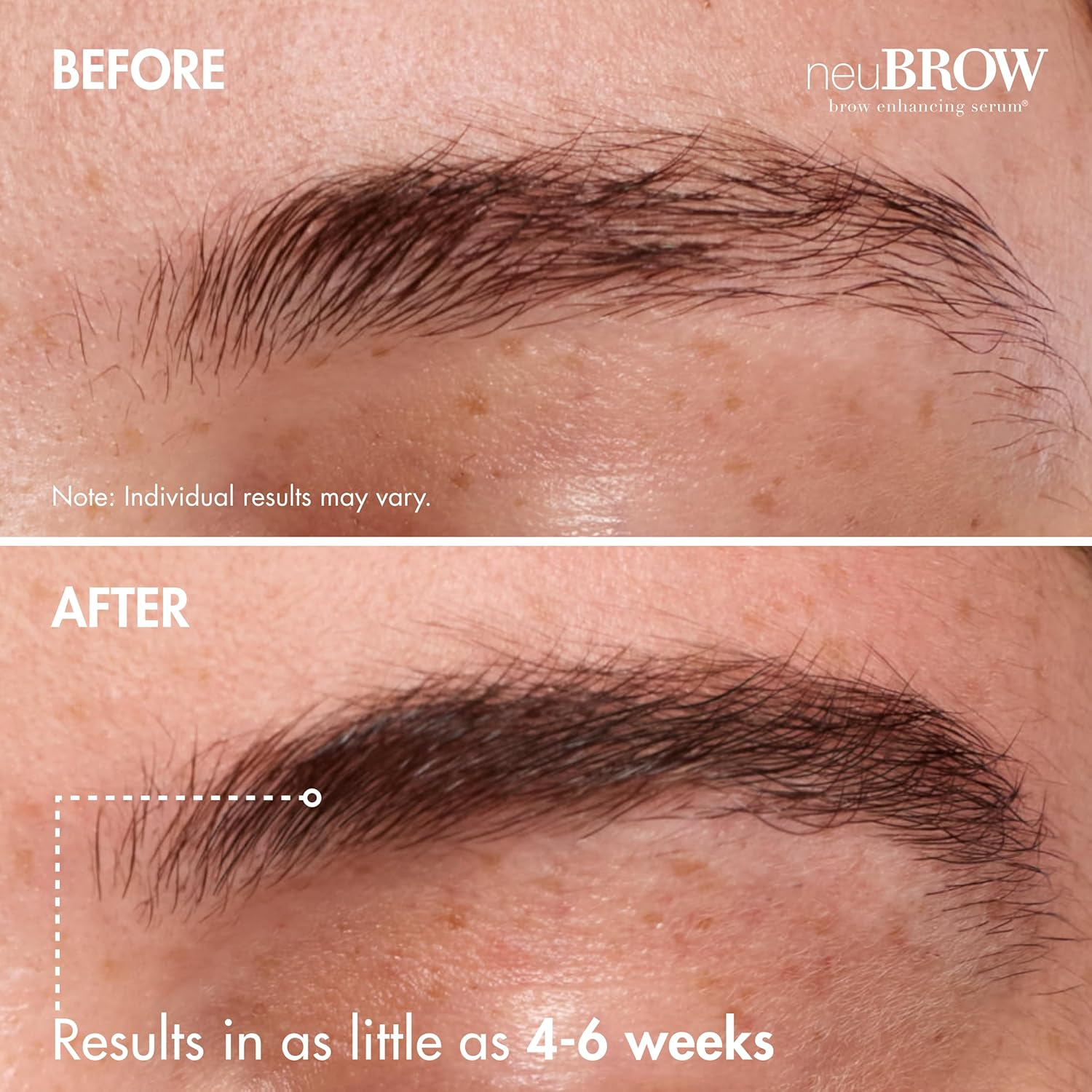 Neubrow Brow Enhancing Serum by Skin Research Laboratories - 3.6 Ml Eye Brow Serum for Defined, Fuller & Thicker-Looking Hair Brows - Advanced Formula Promotes Natural & Healthy Appearance of Brows