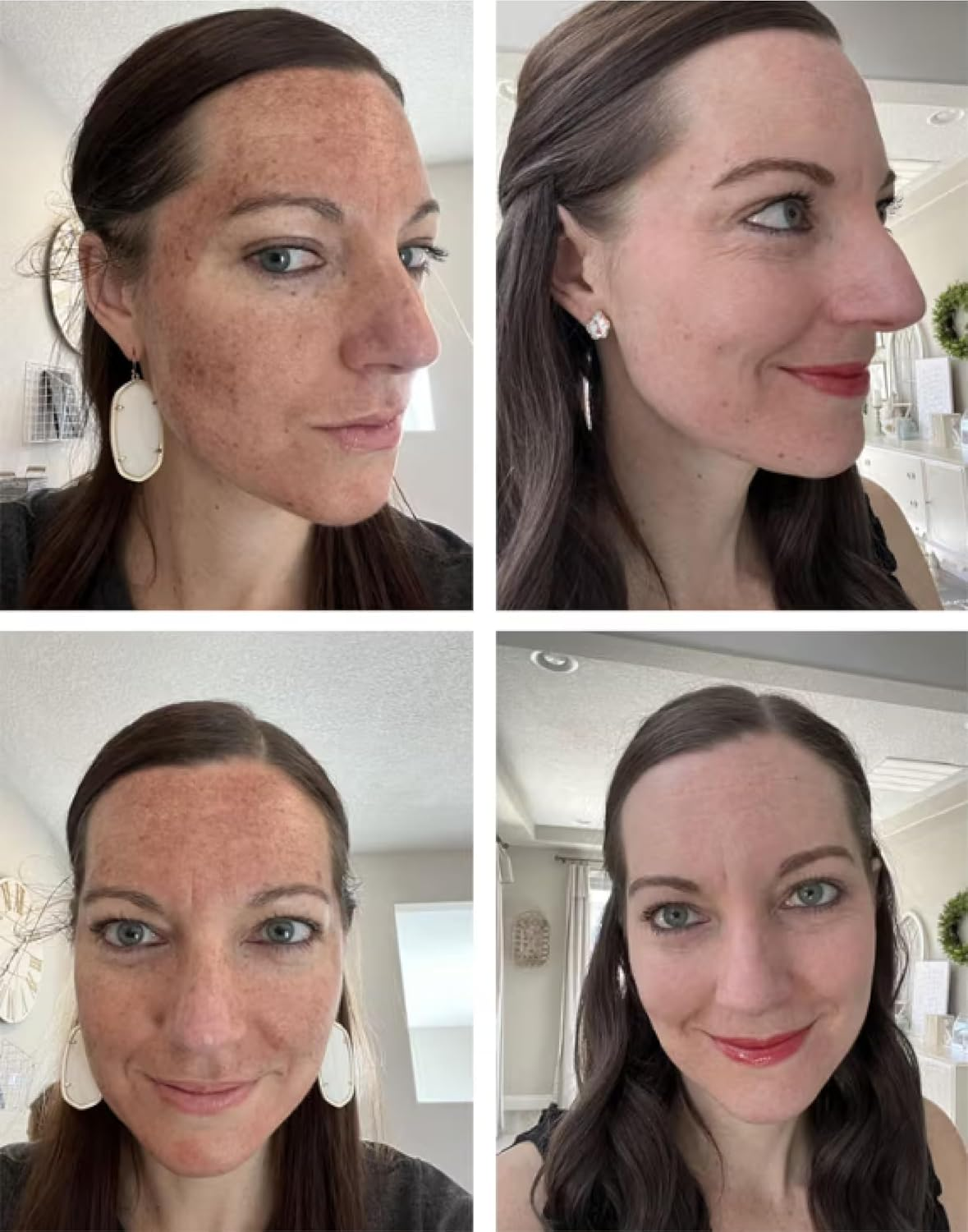 Glycolic Gel Peel 40% (Professional Skin Peel) - Enhanced with Retinol and Green Tea Extract 1FL.OZ/30ML