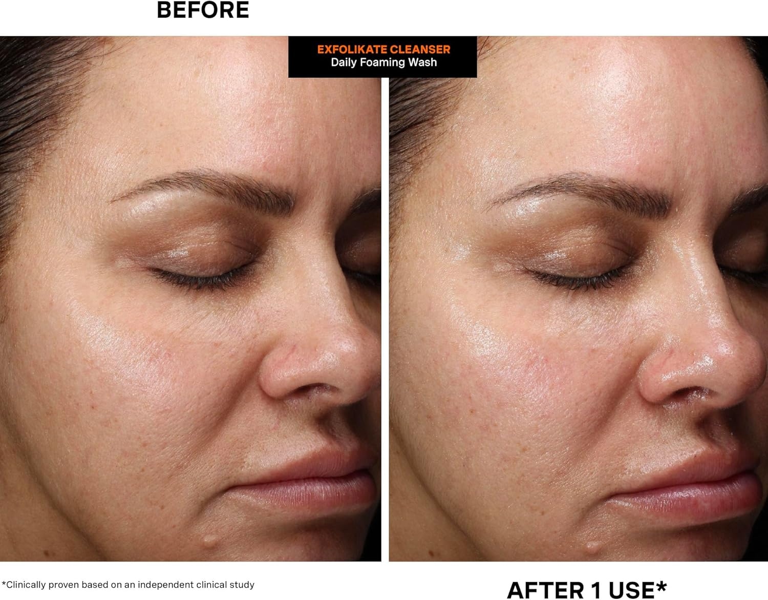 Kate Somerville Exfolikate Daily Foaming Cleanser 120Ml image number 2