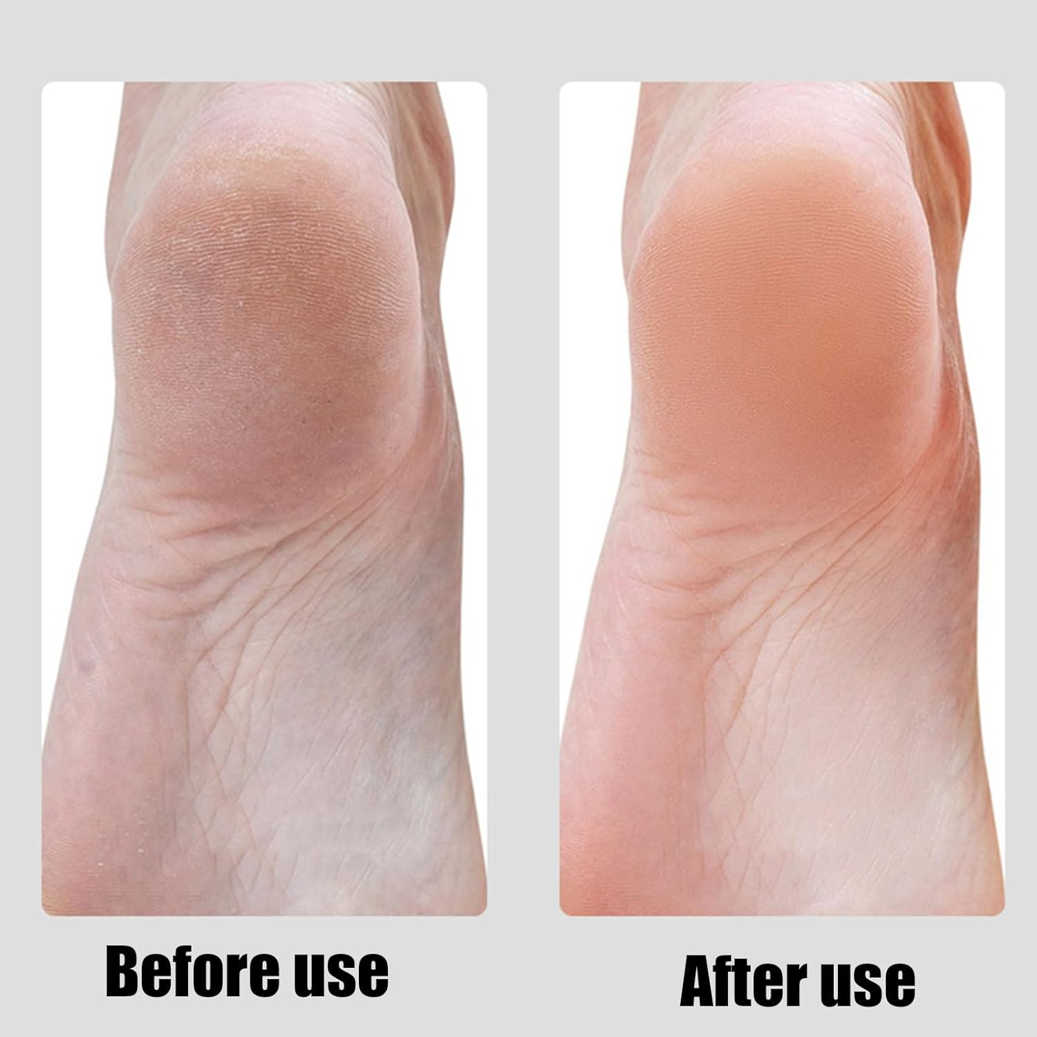 Foot Pumice Stone Pedicure File with Ergonomic Wooden Handle for Smoother Feet and Hands Dead Skin Remover Callus Scraper Foot Scrubber Heel Sander 1 PCS Black image number 2