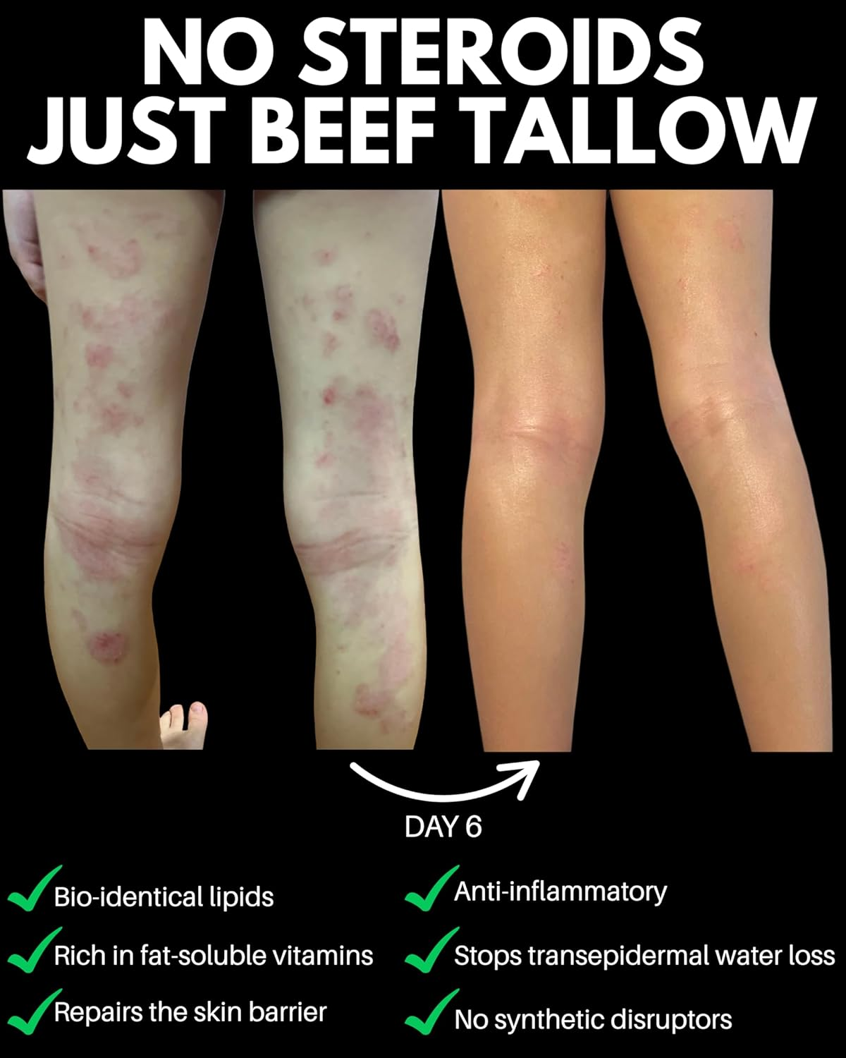 Vanilla-Infused 100% Grass-Fed Beef Tallow Moisturiser 30G image number 6