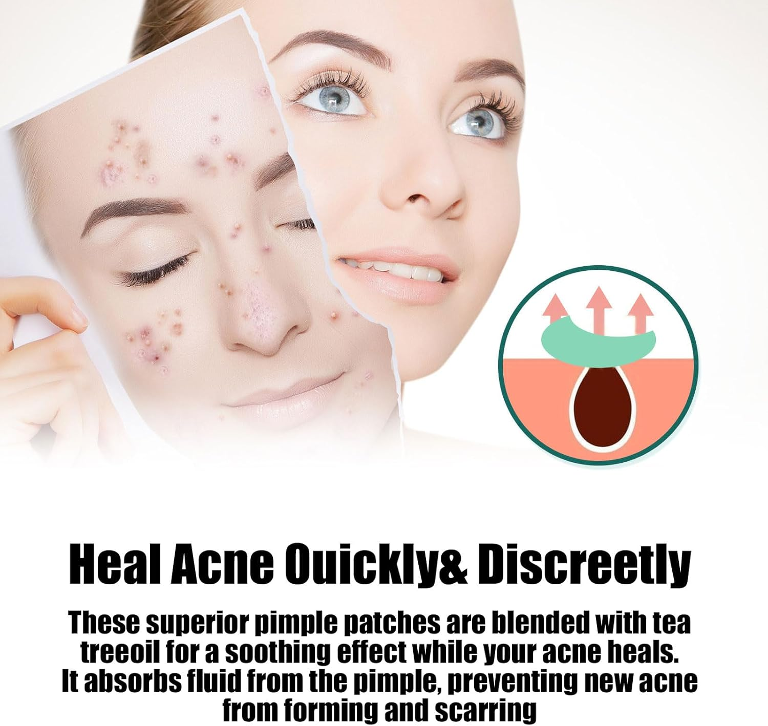 CTOUUGRS Pimple Patches for Face Hydrocolloid Patch Acne Patches Professional 400 Pcs 5 Colors&Sizes(8,10,12,14,16Mm) Starface Pimple Patches Matches Different Size Cute Star Spot Stickers Invisible Zit Absorbing Covering Tea Tree image number 1